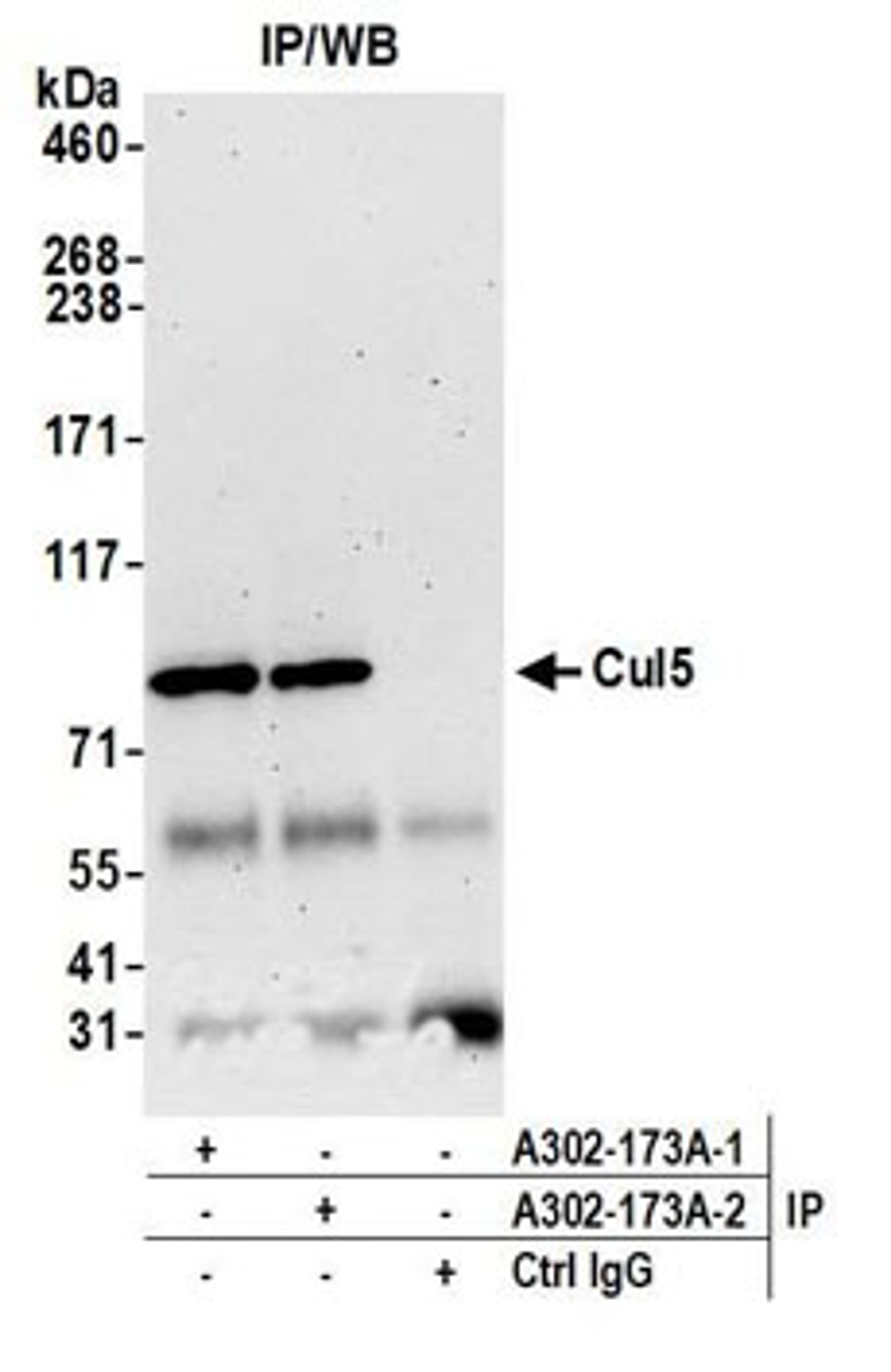 Detection of human Cul5 by western blot of immunoprecipitates.