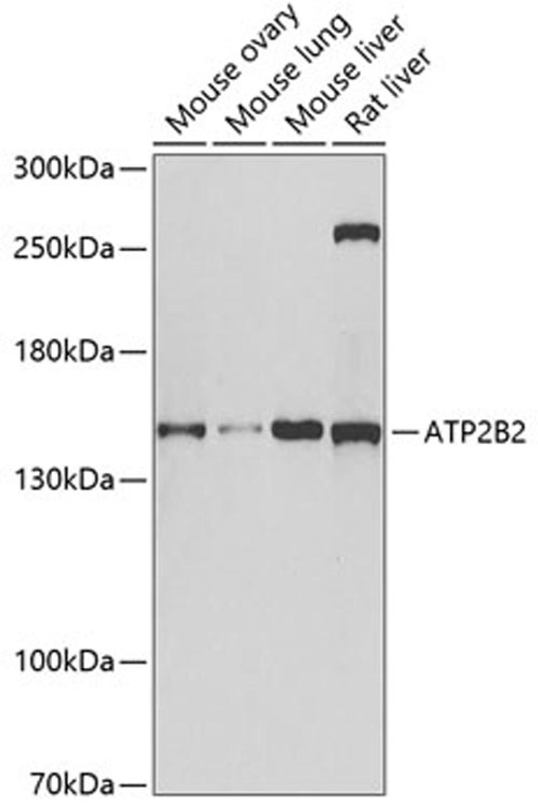 Western blot - ATP2B2 antibody (A6875)