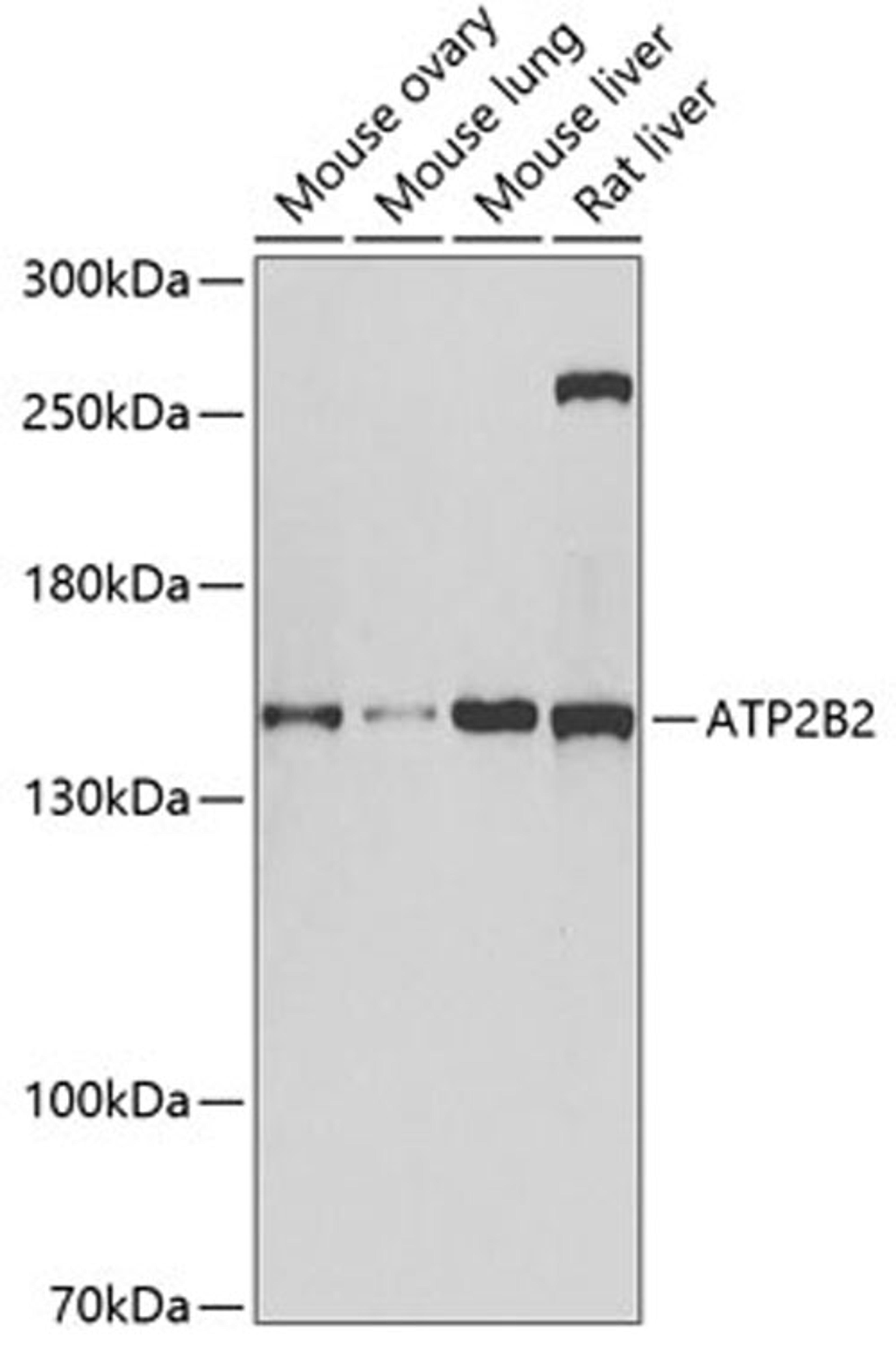 Western blot - ATP2B2 antibody (A6875)