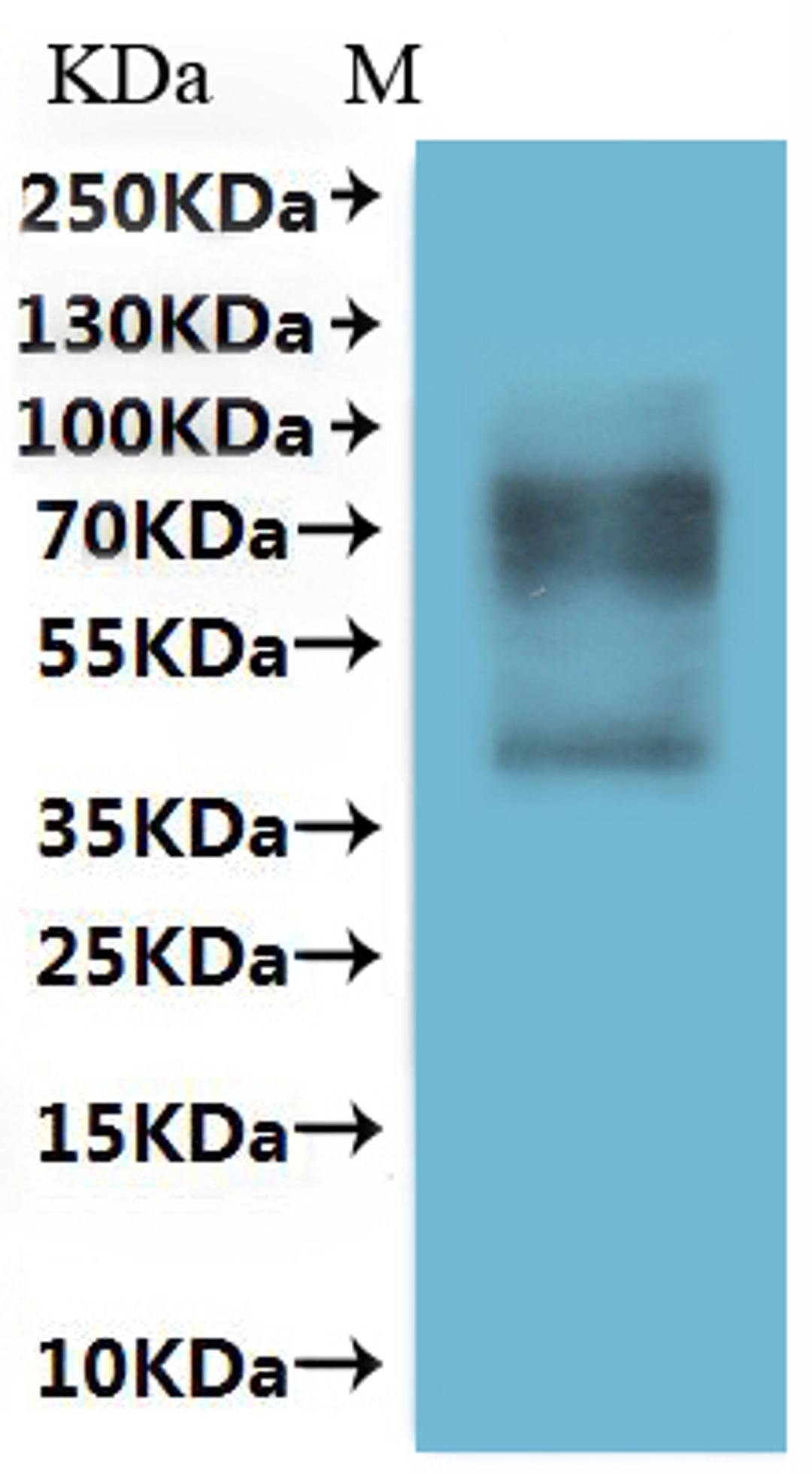 CSB-MP022724HU is detected by Mouse anti-6*His monoclonal antibody.