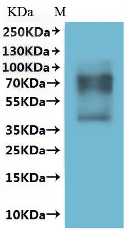 CSB-MP022724HU is detected by Mouse anti-6*His monoclonal antibody.