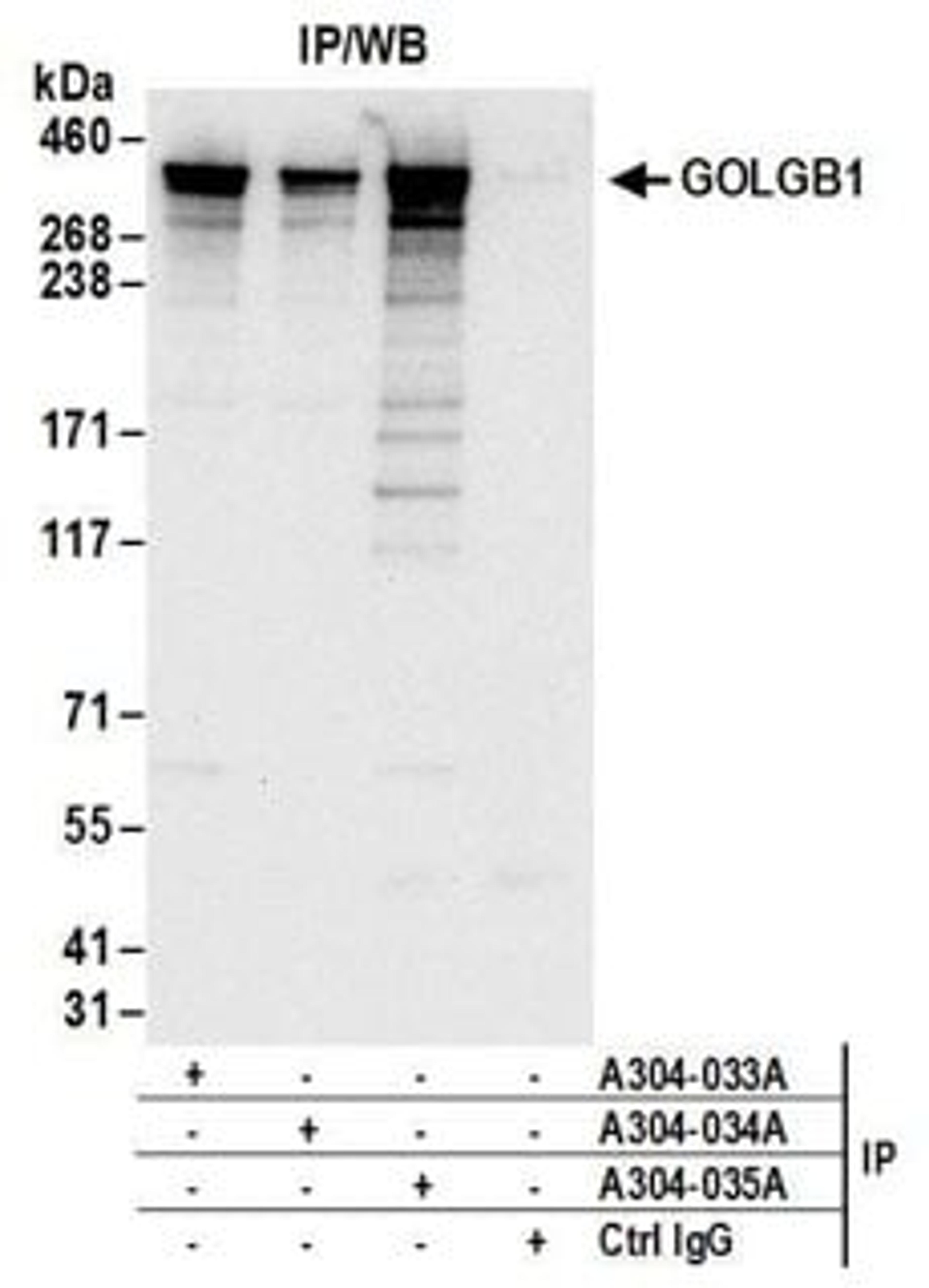 Detection of human GOLGB1 by western blot of immunoprecipitates.