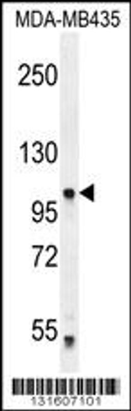 Western blot analysis in MDA-MB435 cell line lysates (35ug/lane).