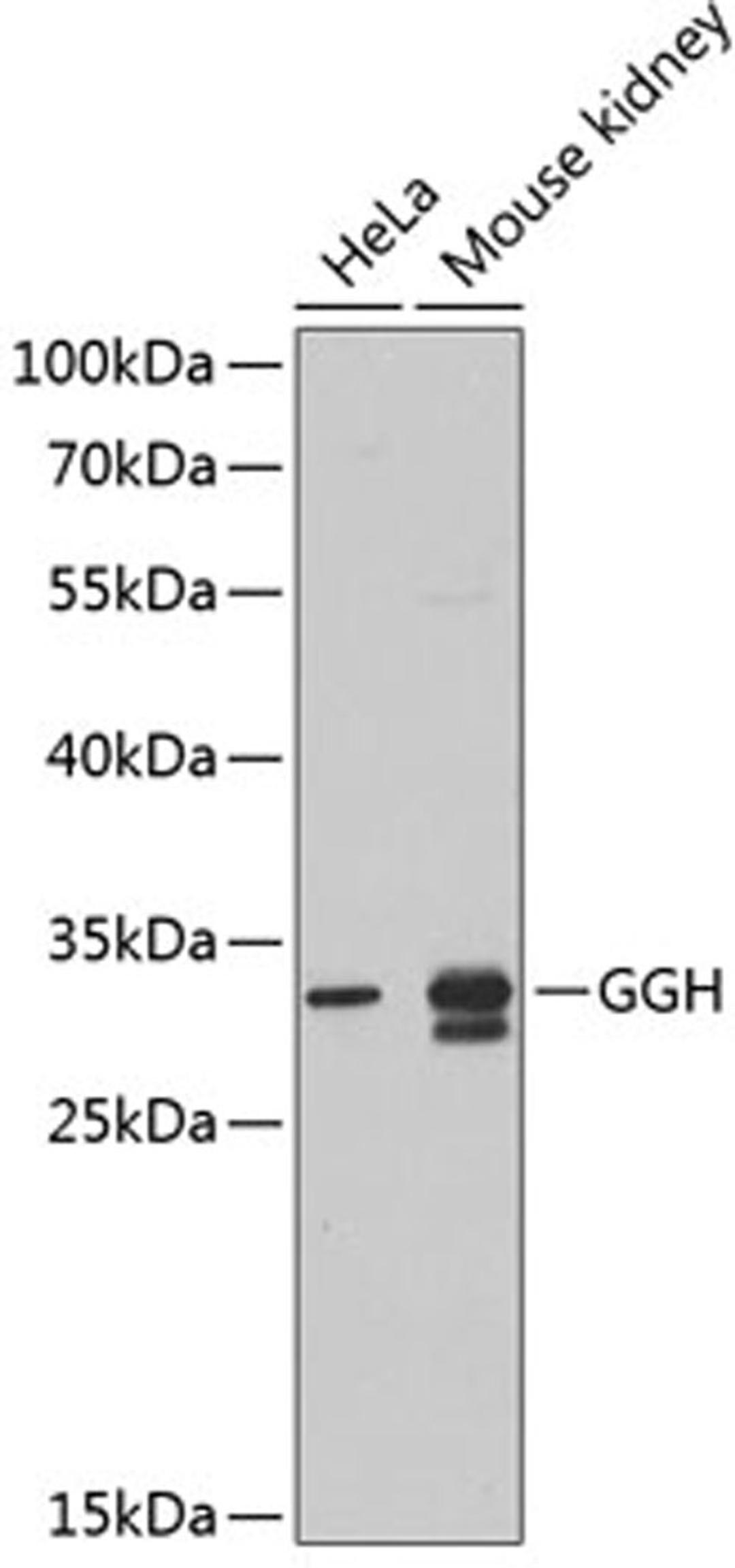 Western blot - GGH antibody (A5464)