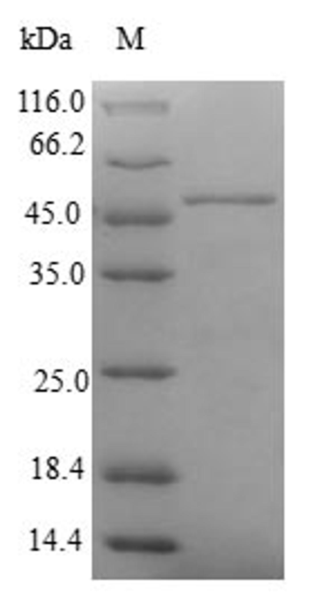 (Tris-Glycine gel) Discontinuous SDS-PAGE (reduced) with 5% enrichment gel and 15% separation gel.
