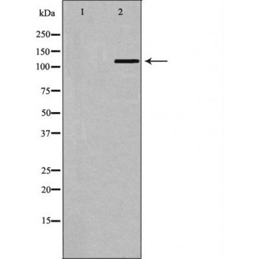 Western blot analysis of mouse testis tissue cell line using BUB1B antibody