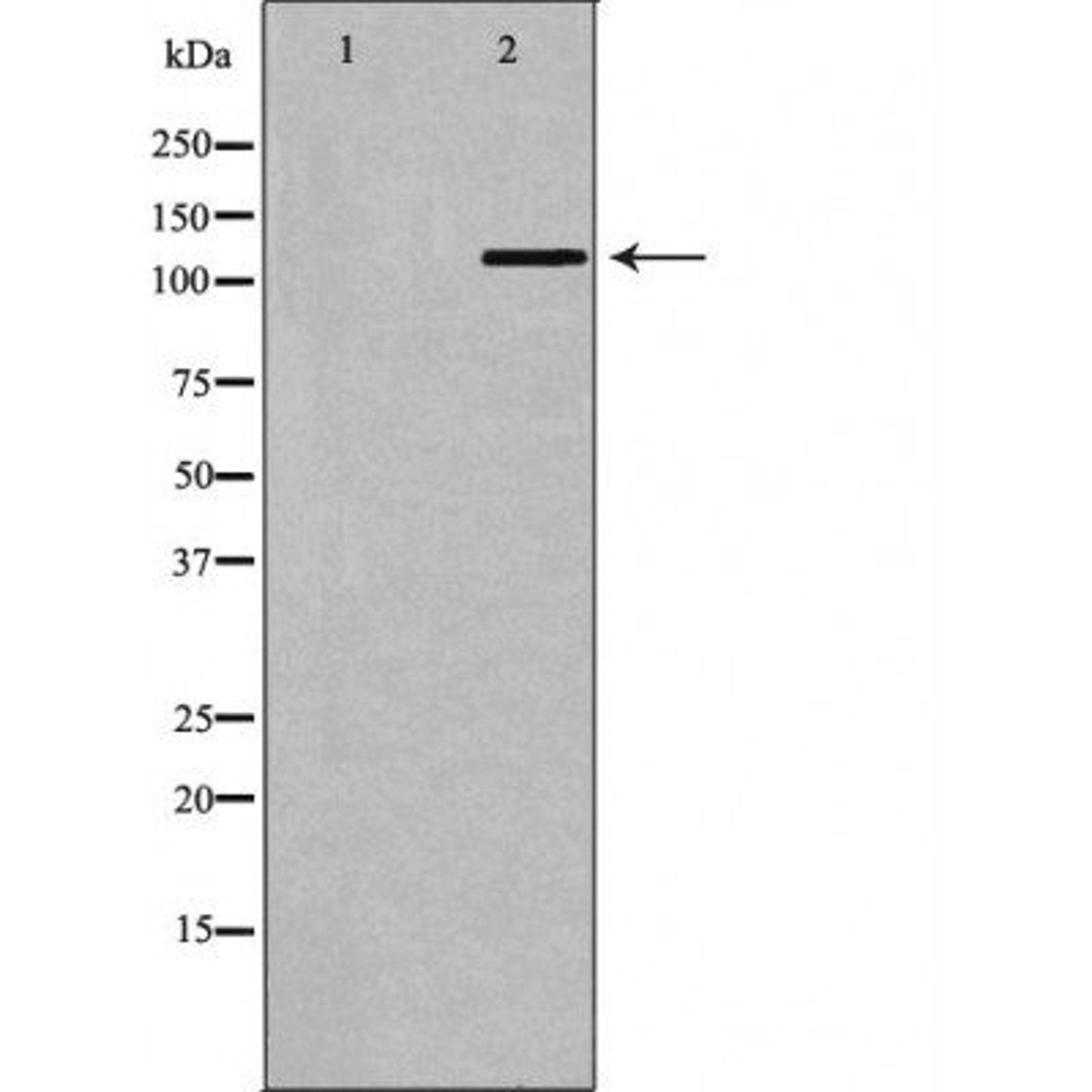 Western blot analysis of mouse testis tissue cell line using BUB1B antibody