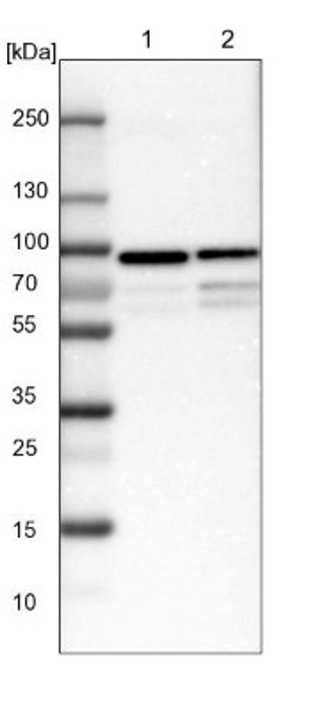 Western Blot: taxilin gamma Antibody [NBP1-90605] - Lane 1: NIH-3T3 cell lysate (Mouse embryonic fibroblast cells)<br/>Lane 2: NBT-II cell lysate (Rat Wistar bladder tumour cells)