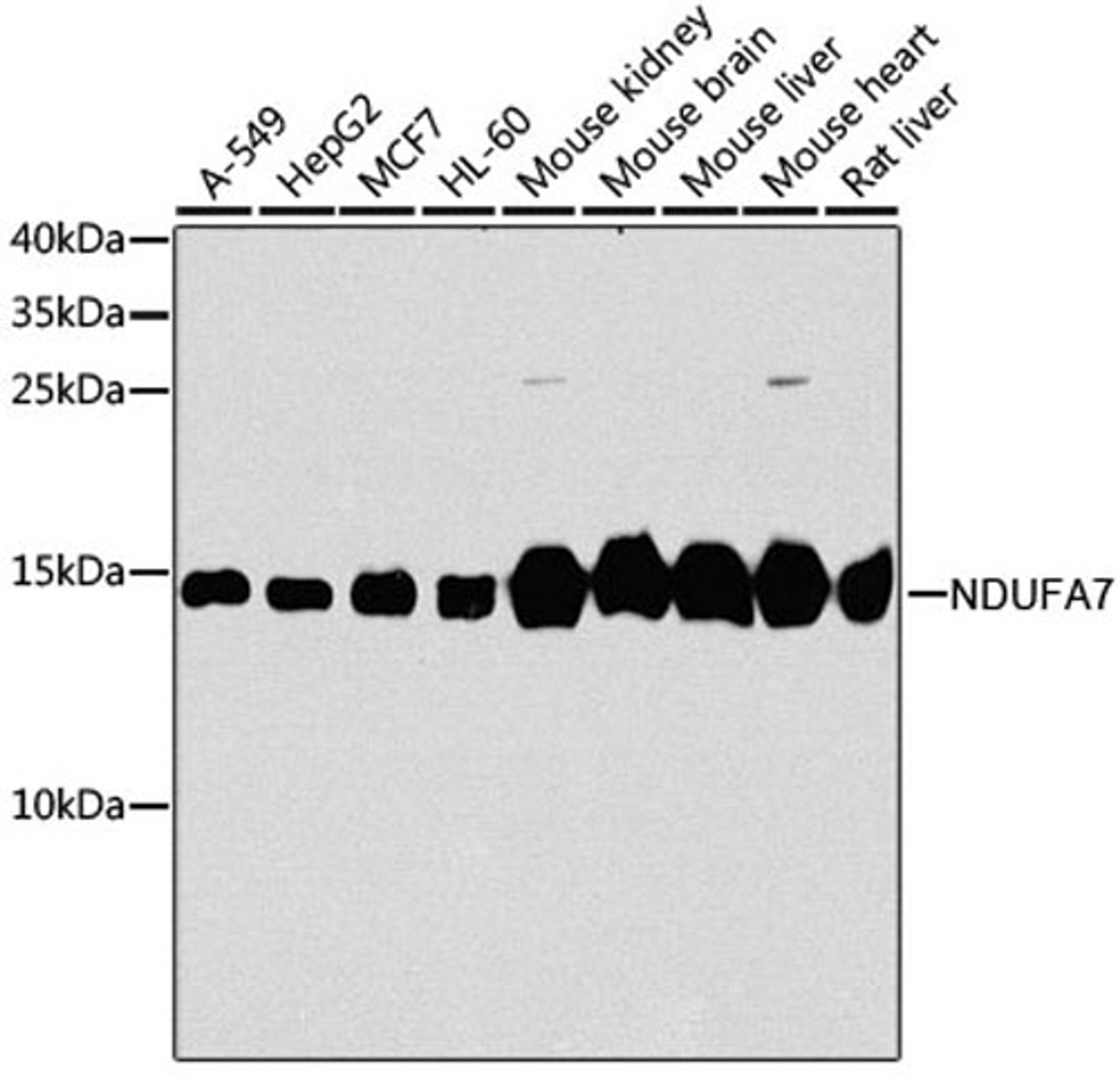 Western blot - NDUFA7 antibody (A8441)