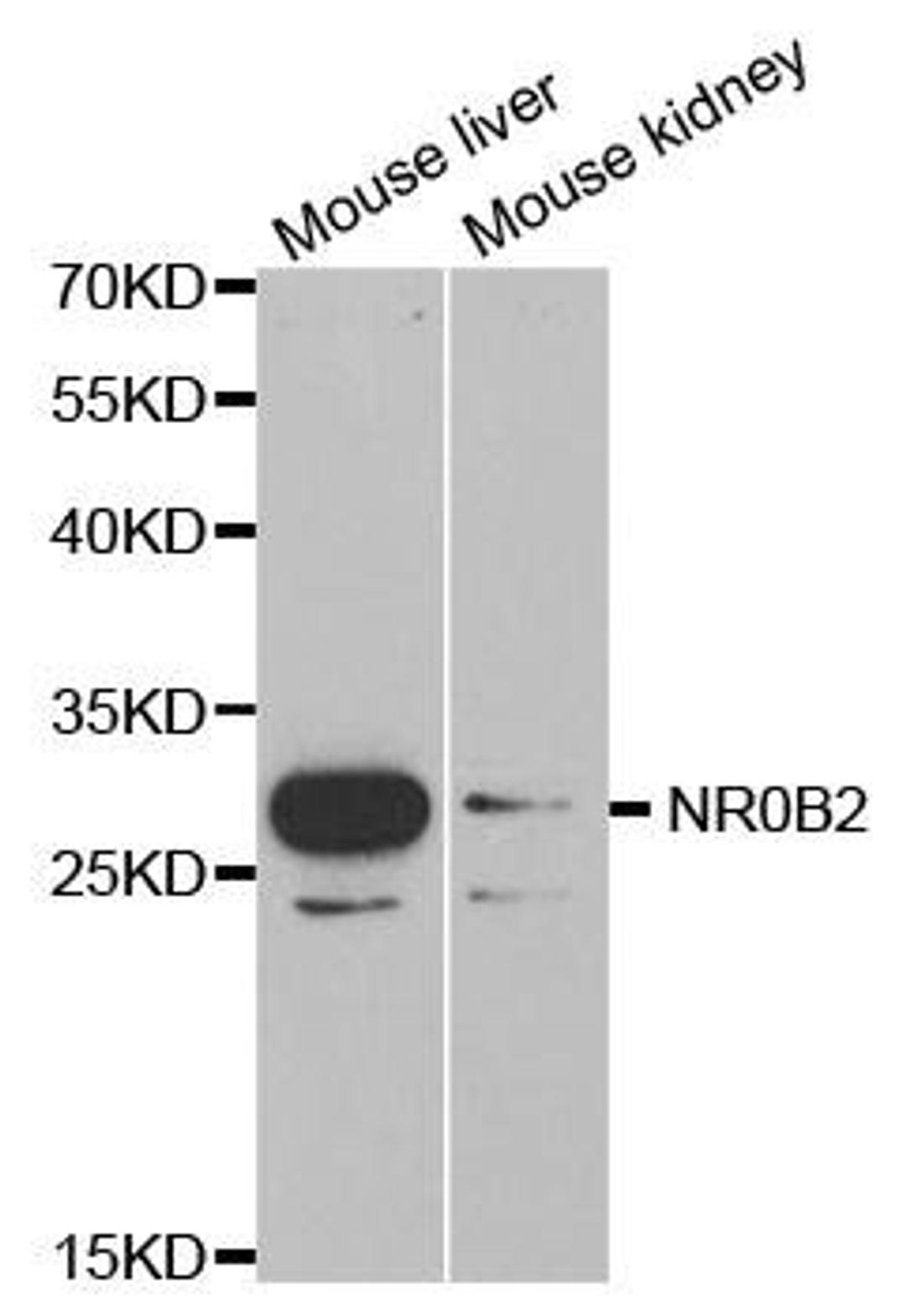 Western blot analysis of extracts of various cell lines using NR0B2 antibody