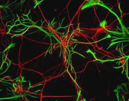 Immunocytochemistry/Immunofluorescence: GFAP Antibody [NB300-141] - Rat neurons stained with Neurofilament Heavy antibody NB300-217 (red) and GFAP antibody NB300-141 (green).