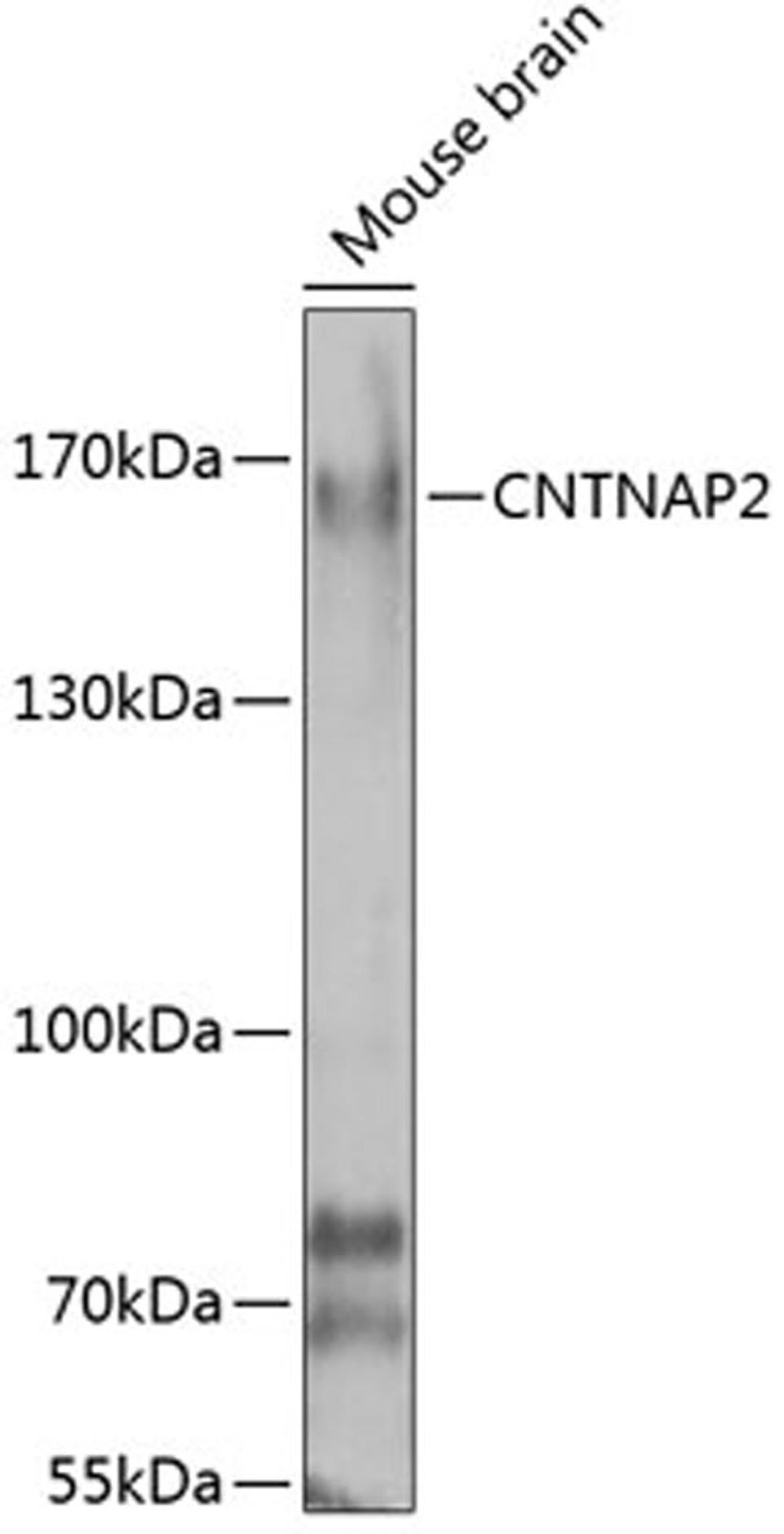 Western blot - CNTNAP2 antibody (A7466)