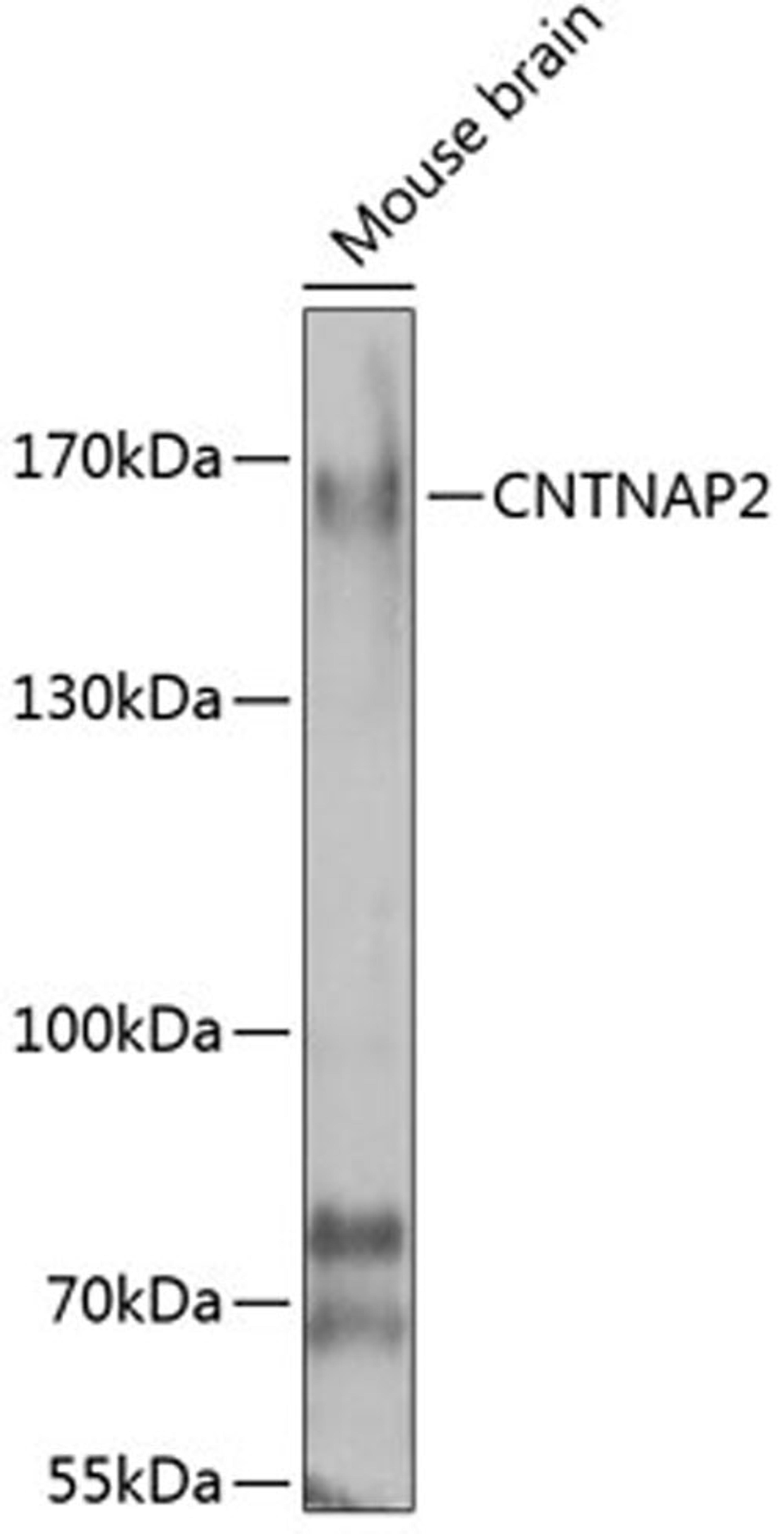 Western blot - CNTNAP2 antibody (A7466)