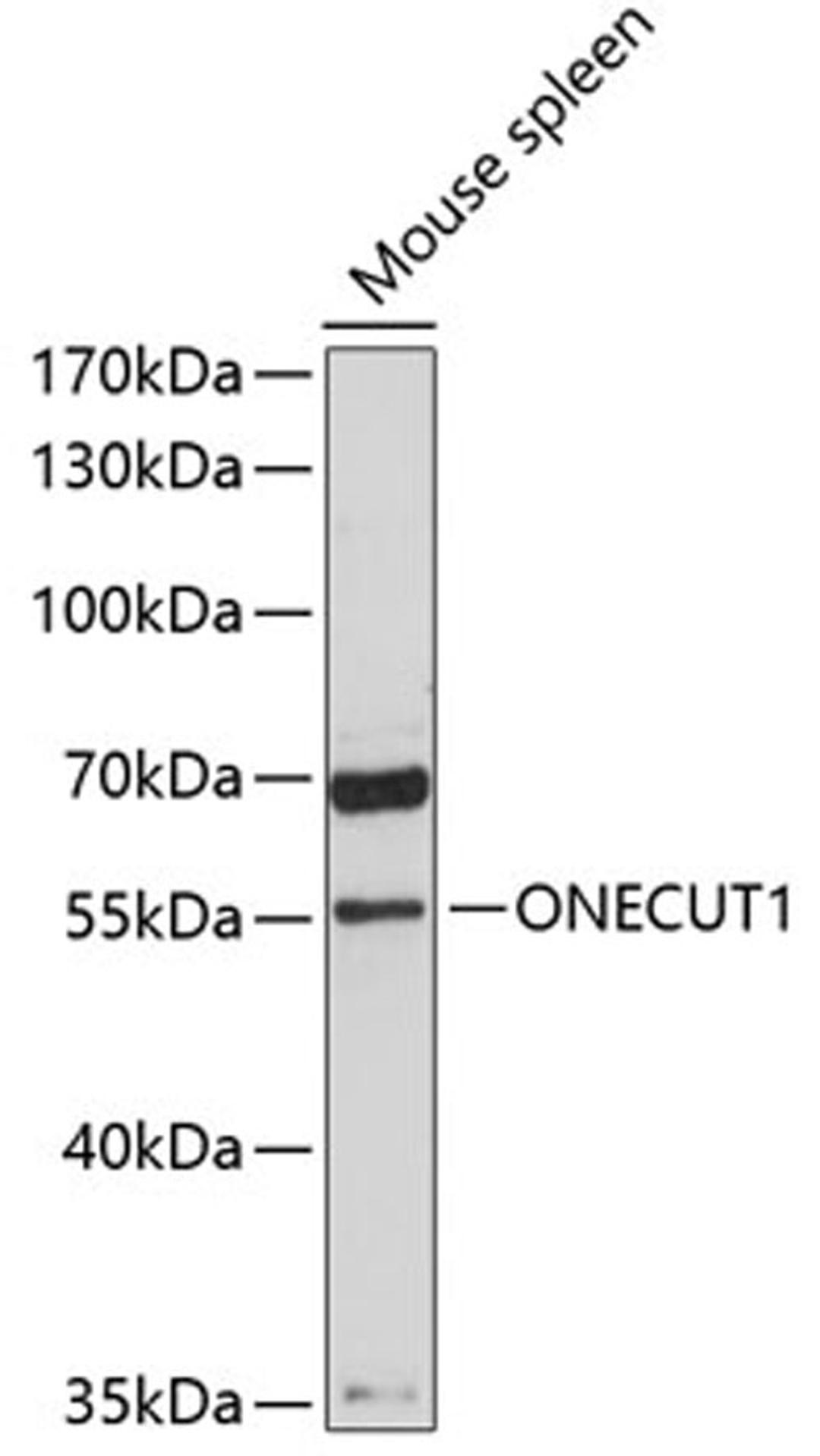 Western blot - ONECUT1 antibody (A9668)