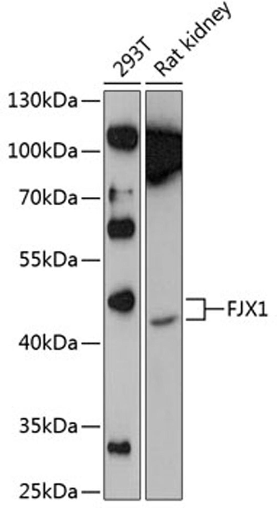 Western blot - FJX1 Antibody (A9268)