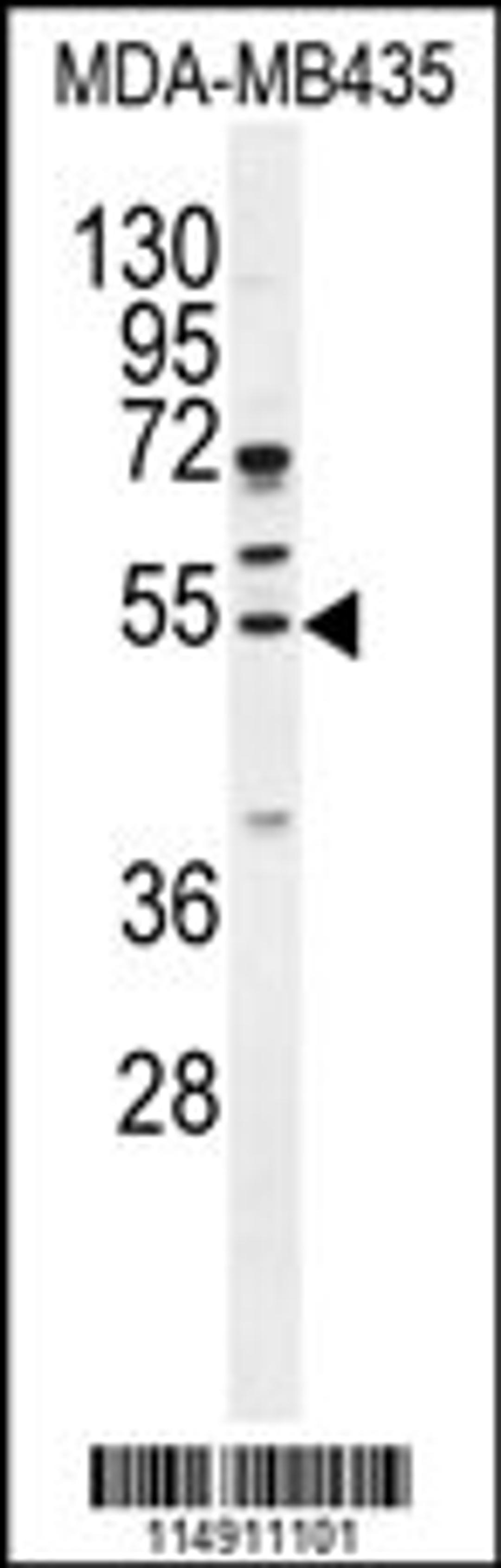 Western blot analysis in MDA-MB435 cell line lysates (35ug/lane).