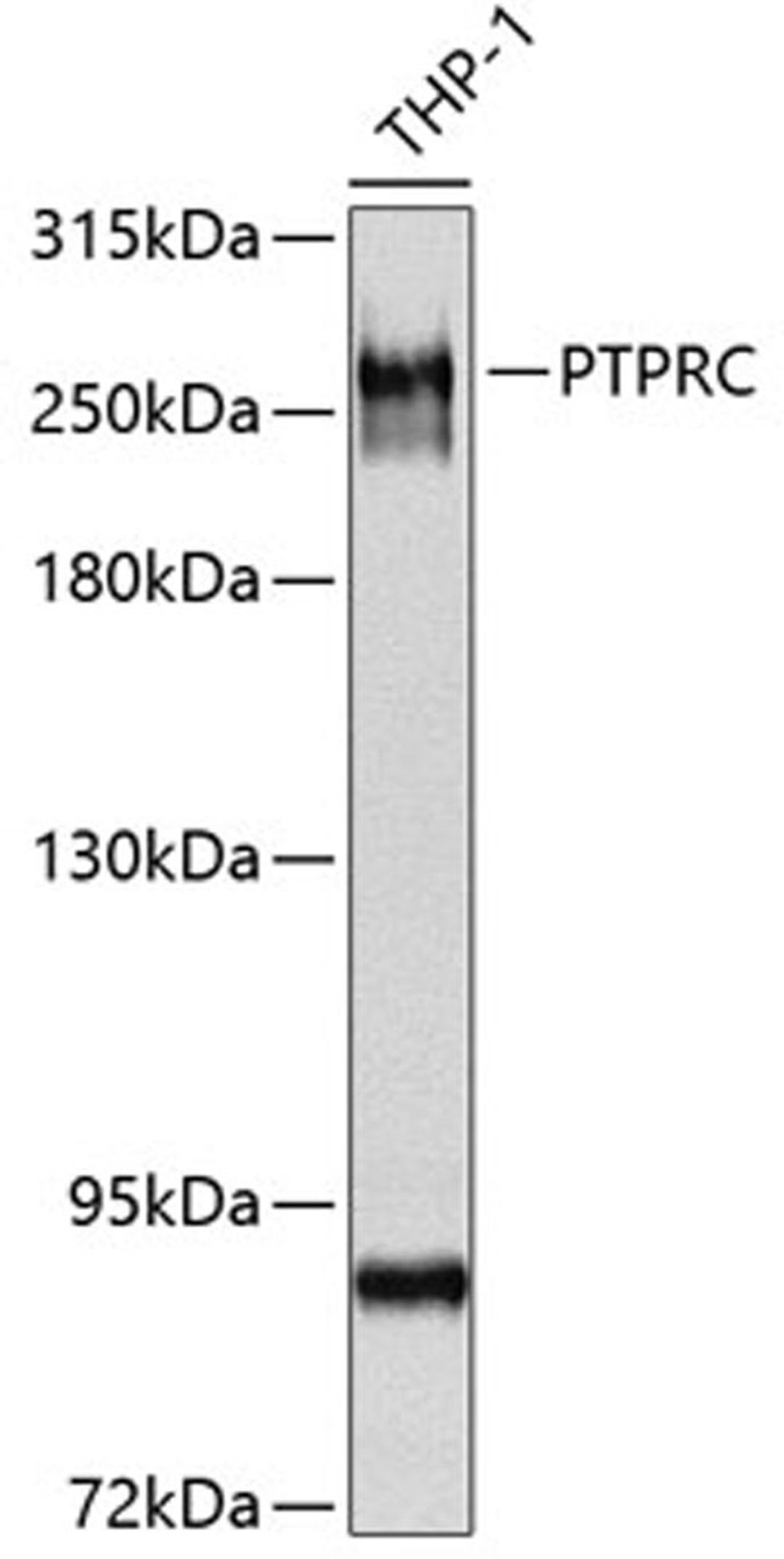 Western blot - PTPRC antibody (A0372)