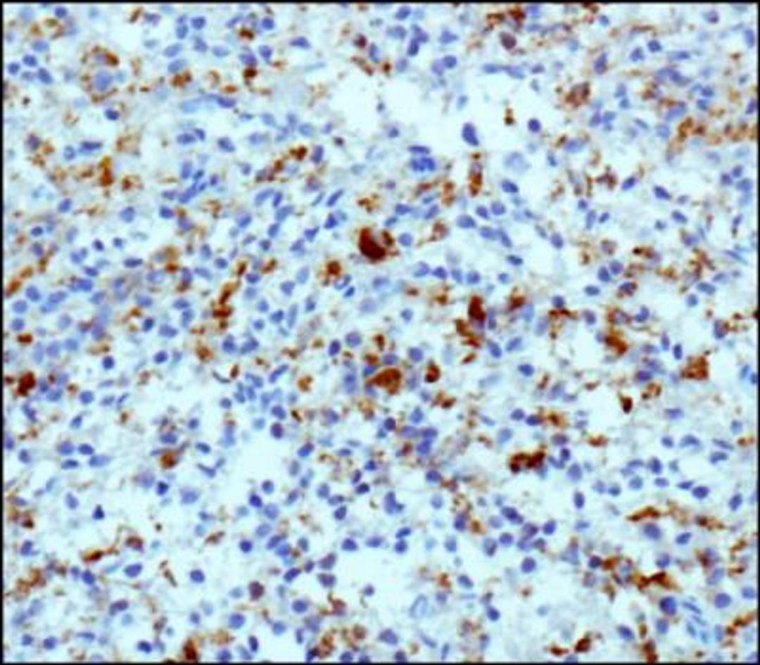 Immunohistochemistry-Paraffin: CD68 Antibody (KP1) [NB100-683] - IHC staining of CD68 in human spleen using DAB with hematoxylin counterstain.