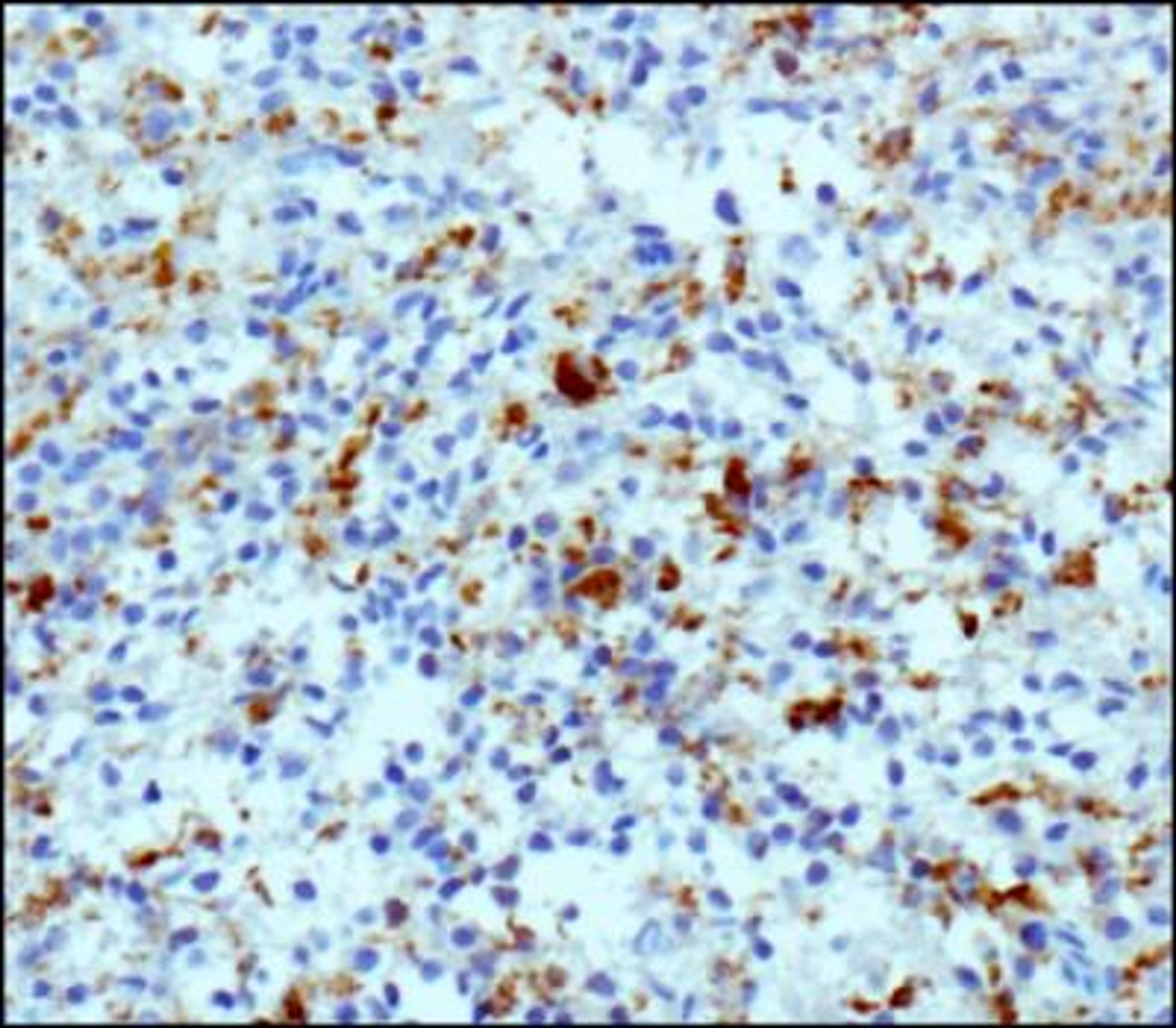 Immunohistochemistry-Paraffin: CD68 Antibody (KP1) [NB100-683] - IHC staining of CD68 in human spleen using DAB with hematoxylin counterstain.