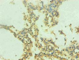 Immunohistochemical of paraffin-embedded human lung tissue using CSB-MA0206421A0m at dilution of 1:200