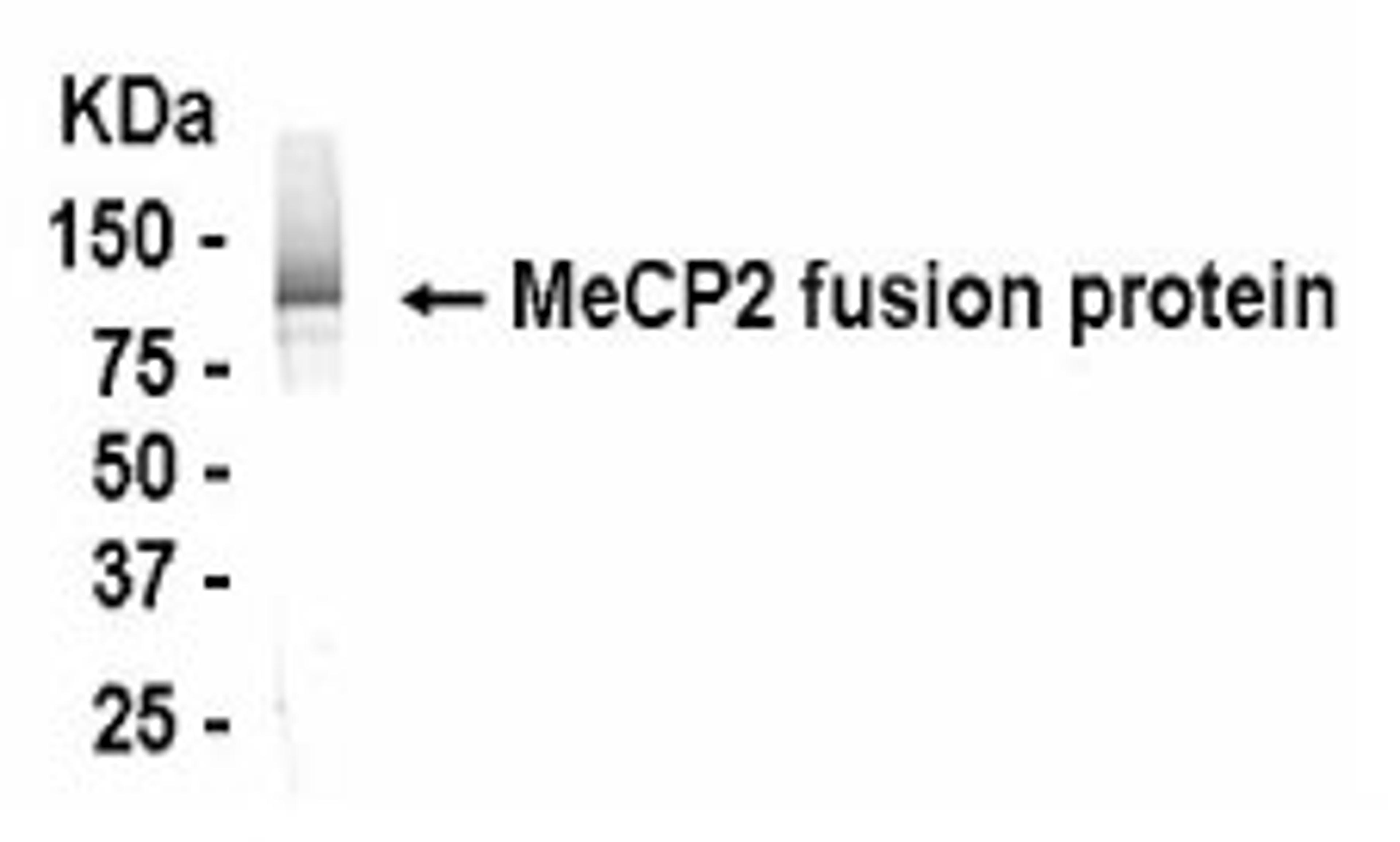 Western blot detection of MeCP2 antibody.