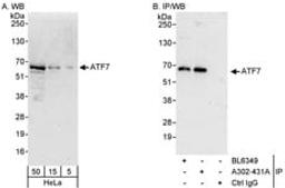 Detection of human ATF7 by western blot and immunoprecipitation.