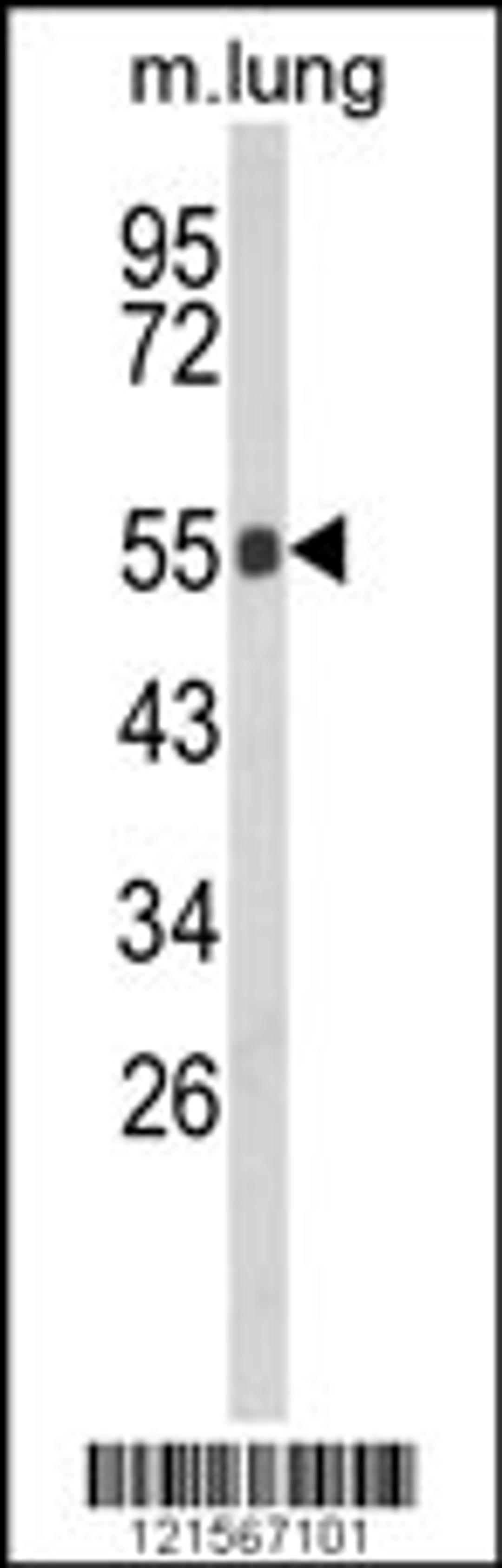 Western blot analysis of GC Antibody in mouse lung tissue lysates (35ug/lane)