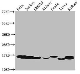 Western Blot. Positive WB detected in: Hela cell acid extracts, Jurkat cell acid extracts, HEK293 cell acid extracts, Rat kidney tissue, Mouse brain tissue, Mouse liver tissue, Mouse kidney tissue. All lanes: HIST1H3A antibody at 2µg/ml. Secondary. Goat polyclonal to rabbit IgG at 1/50000 dilution. Predicted band size: 16 kDa. Observed band size: 16 kDa