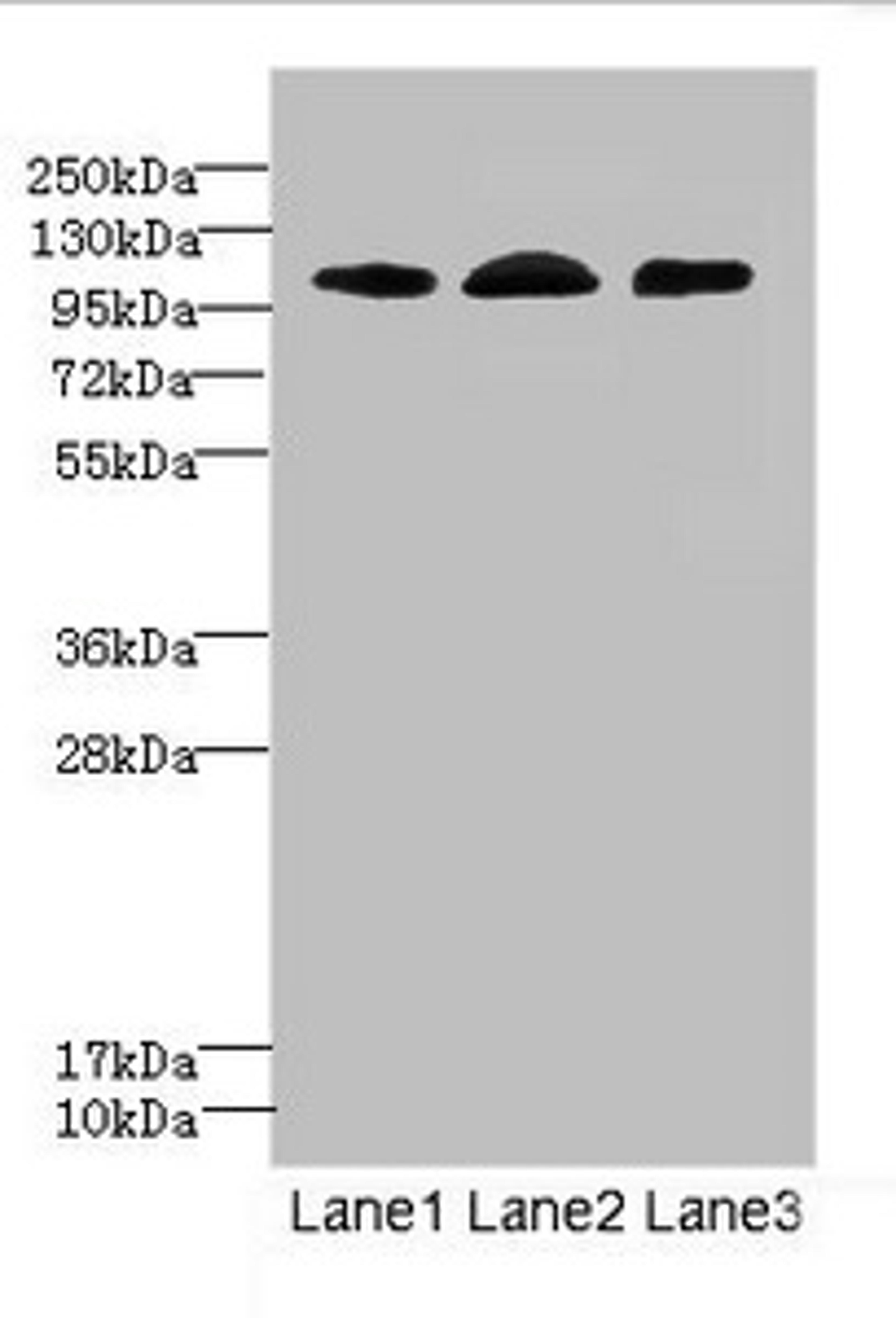 Western blot. All lanes: EPHB4 antibody at 2.71ug/ml. Lane 1: A549 whole cell lysate. Lane 2: 293T whole cell lysate. Lane 3: Hela whole cell lysate. Secondary. Goat polyclonal to rabbit IgG at 1/10000 dilution. Predicted band size: 109, 56, 34, 46 kDa. Observed band size: 109 kDa. 