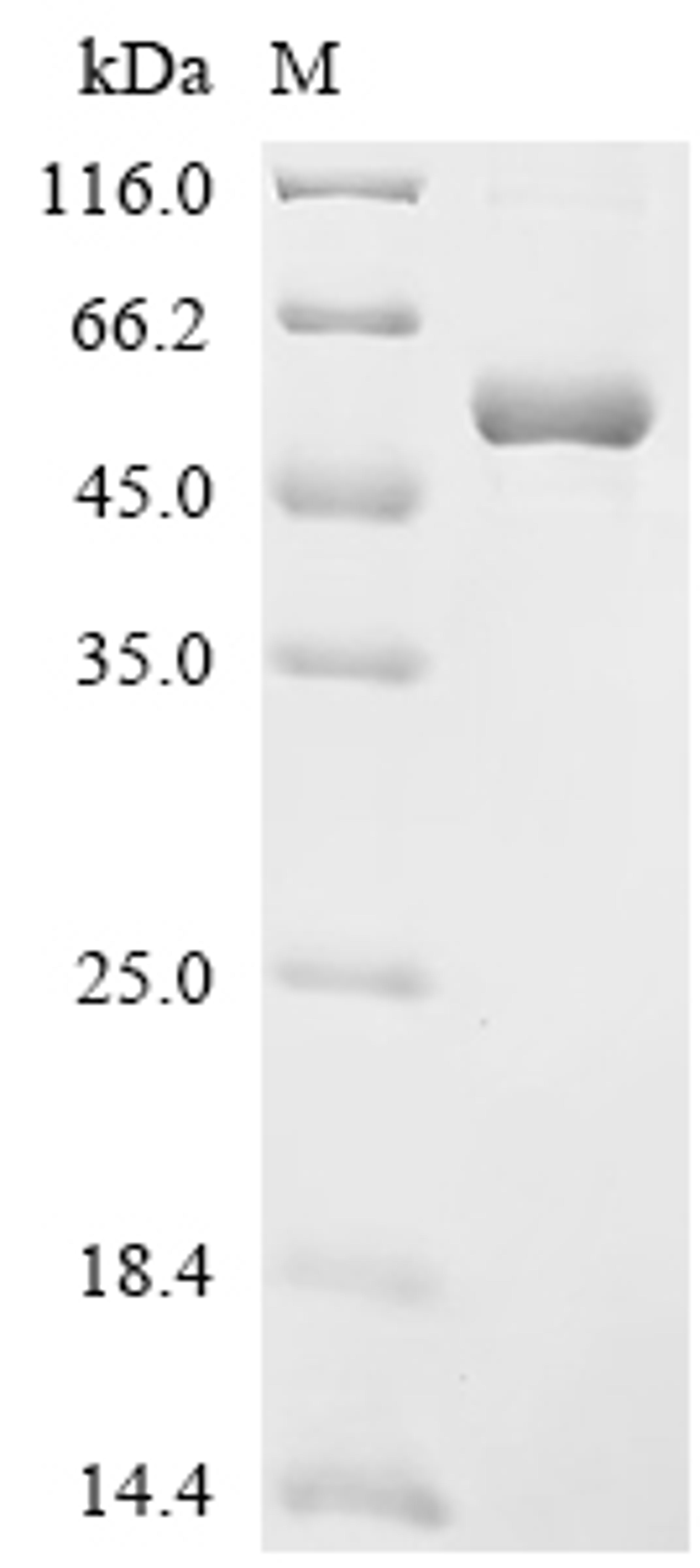 (Tris-Glycine gel) Discontinuous SDS-PAGE (reduced) with 5% enrichment gel and 15% separation gel.