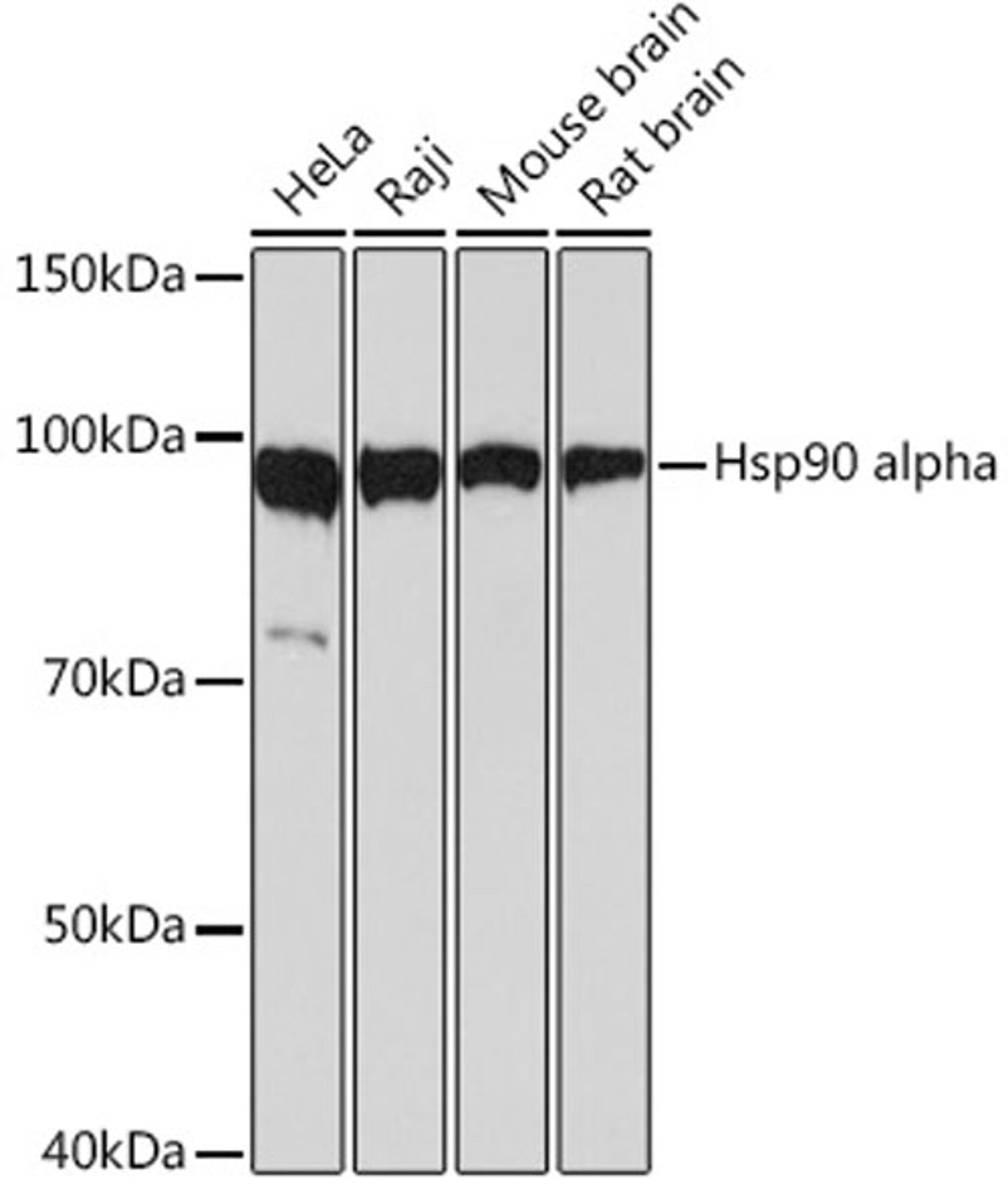 Western blot - Hsp90 alpha Rabbit mAb (A5006)