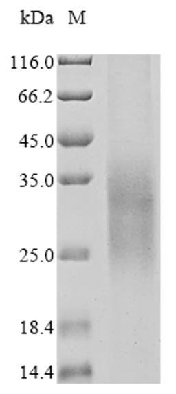 (Tris-Glycine gel) Discontinuous SDS-PAGE (reduced) with 5% enrichment gel and 15% separation gel.