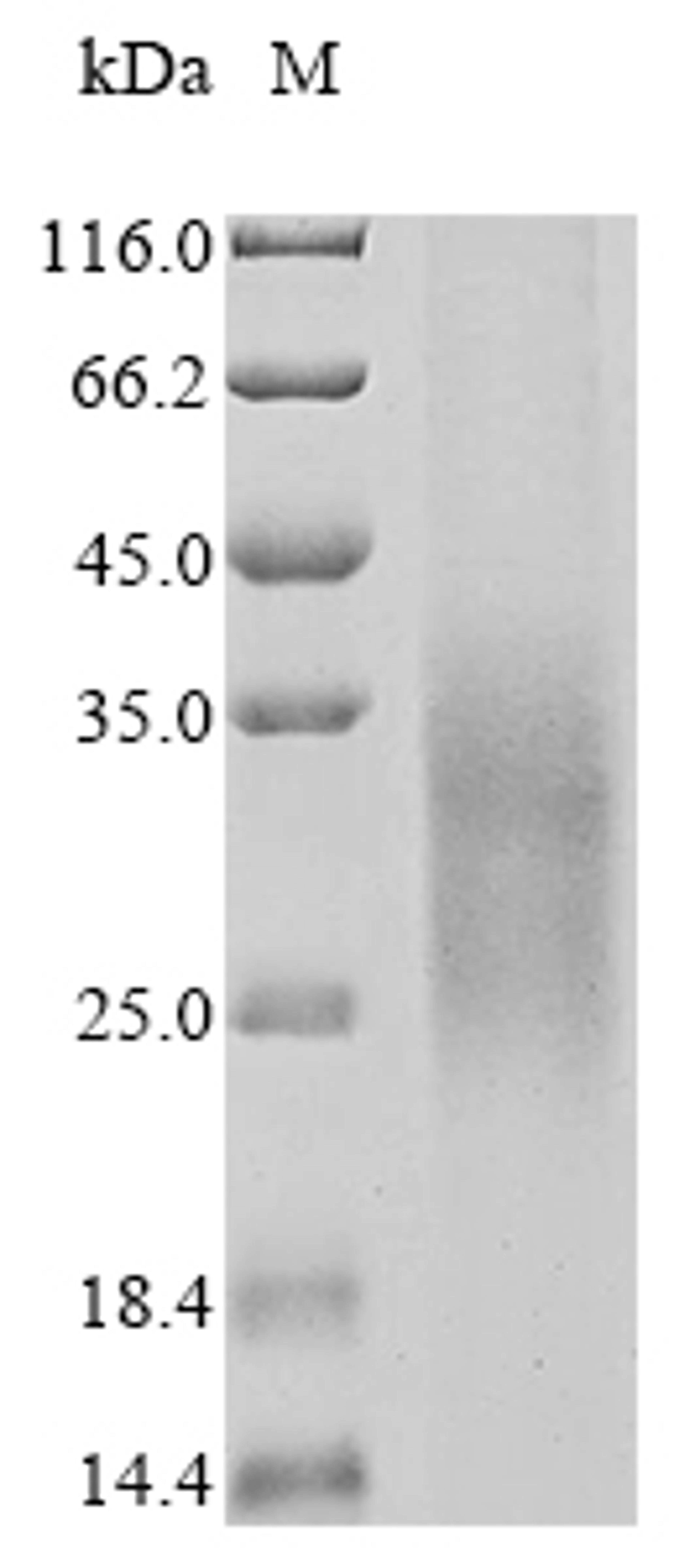 (Tris-Glycine gel) Discontinuous SDS-PAGE (reduced) with 5% enrichment gel and 15% separation gel.