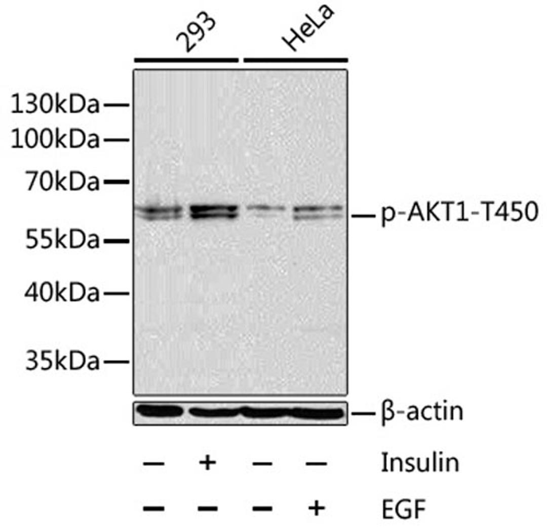 Western blot - Phospho-AKT1-T450 antibody (AP0004)