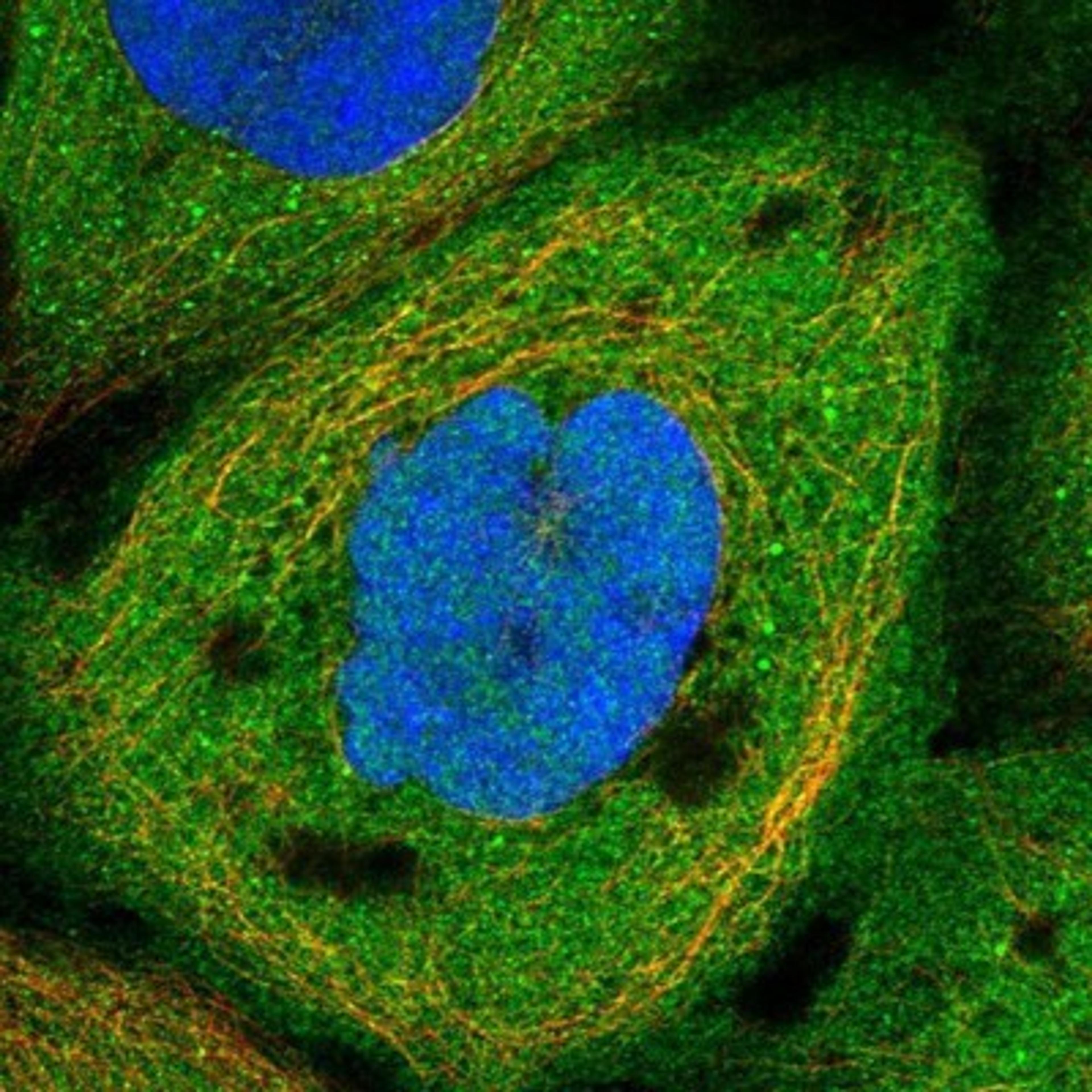 Immunocytochemistry/Immunofluorescence: p114RhoGEF Antibody [NBP1-92238] - Staining of human cell line A-431 shows positivity in plasma membrane & cytoplasm.