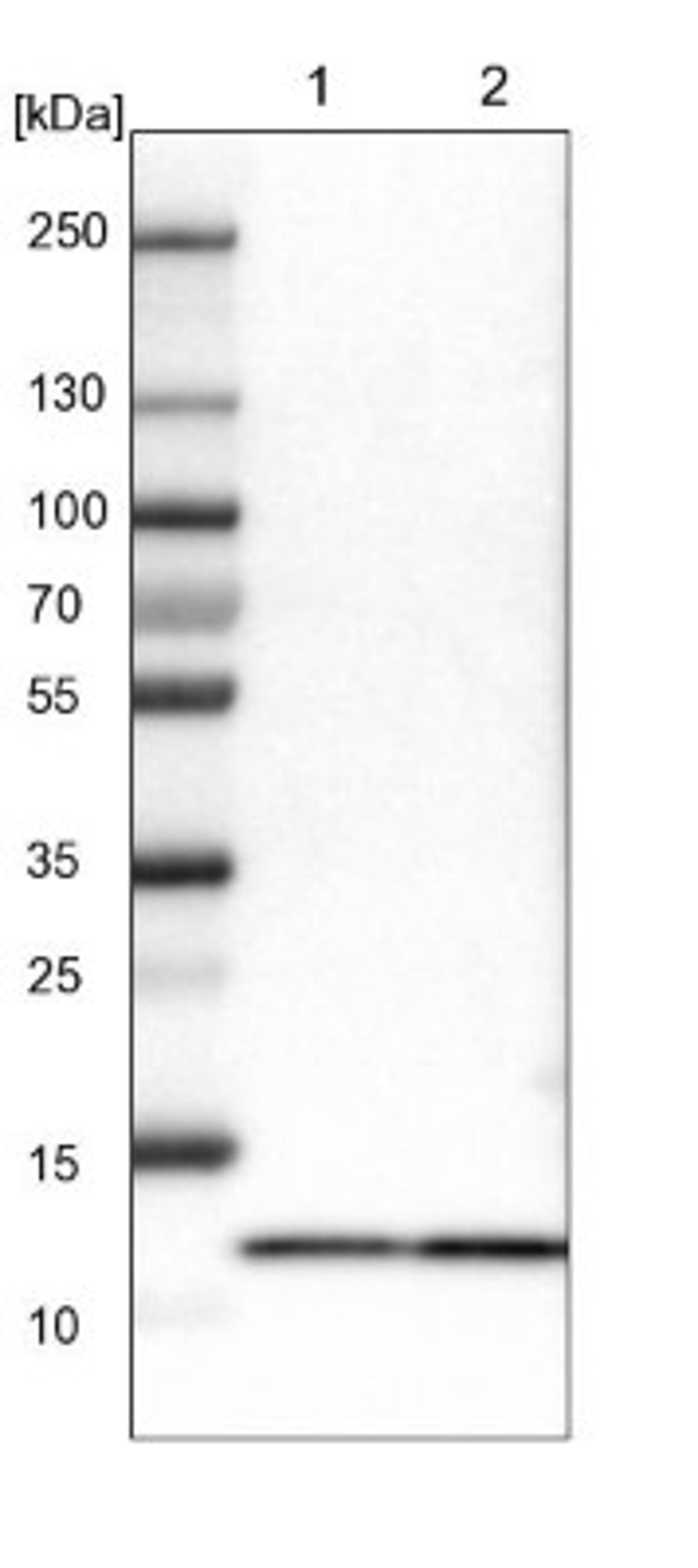 Western Blot: Myotrophin Antibody [NBP1-89787] - Lane 1: NIH-3T3 cell lysate (Mouse embryonic fibroblast cells)<br/>Lane 2: NBT-II cell lysate (Rat Wistar bladder tumour cells)