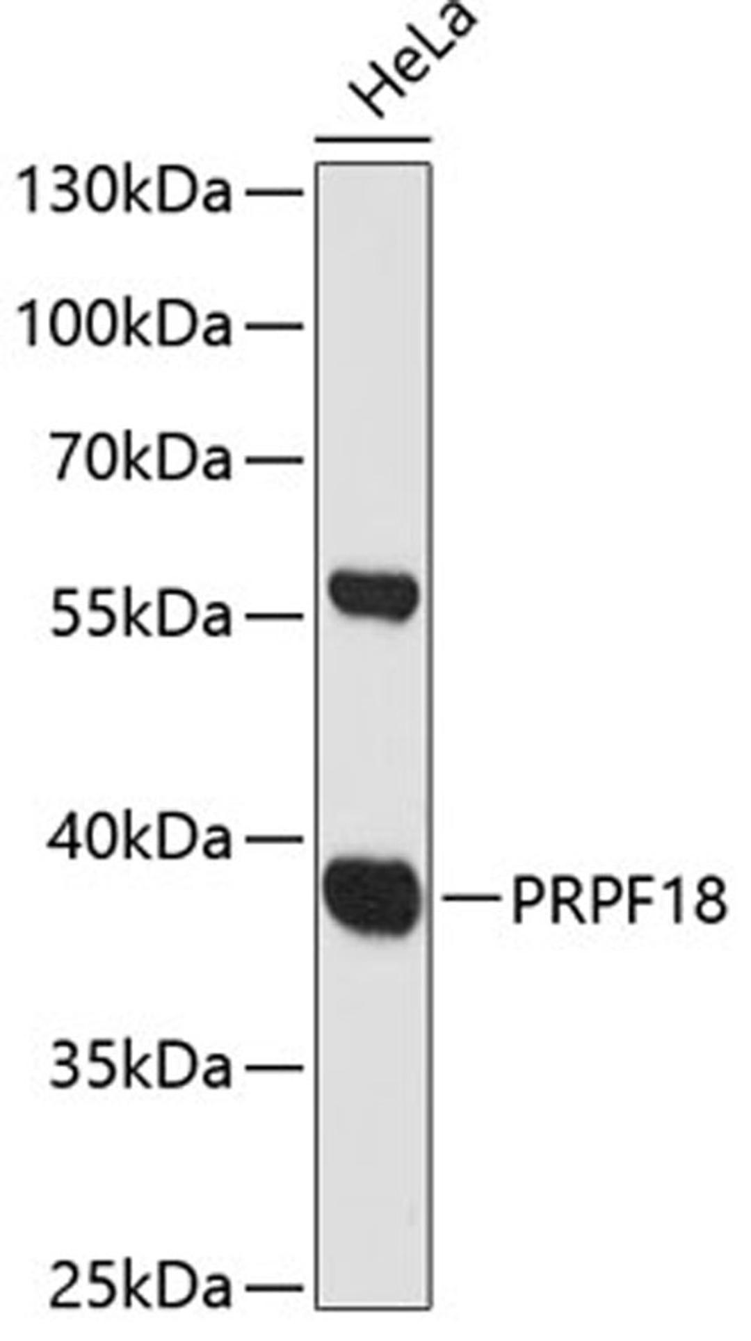 Western blot - PRPF18 antibody (A12817)