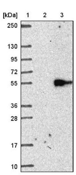 Western Blot: CAT1 Antibody [NBP1-90066] - Lane 1: Marker [kDa] 250, 130, 95, 72, 55, 36, 28, 17, 10<br/>Lane 2: Negative control (vector only transfected HEK293T lysate)<br/>Lane 3: Over-expression lysate (Co-expressed with a C-terminal myc-DDK tag (~3.1 kDa) in mammalian HEK293T cells, LY418941)