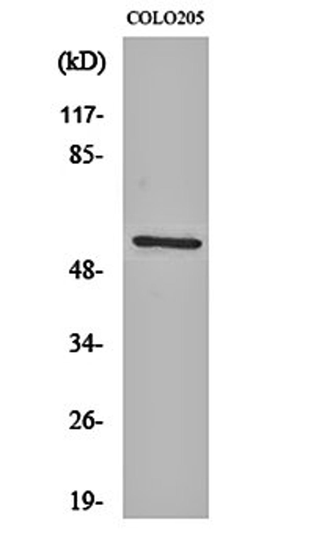 Western blot analysis of COLO205 cell lysates using Ikaros 3 antibody