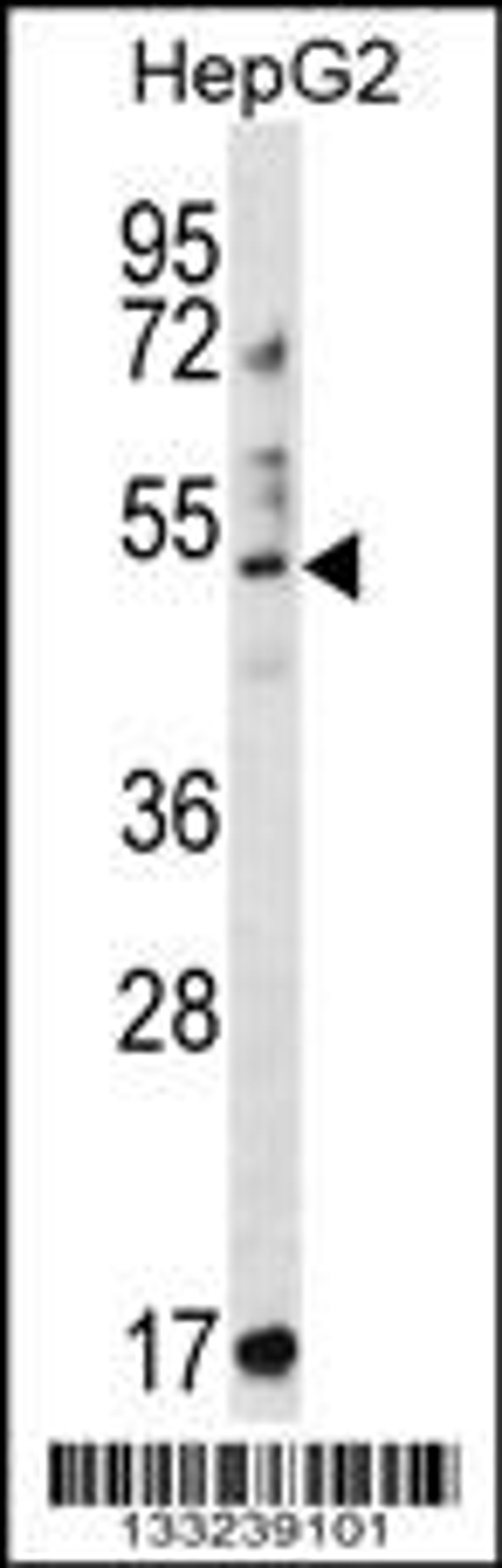 Western blot analysis in HepG2 cell line lysates (35ug/lane).