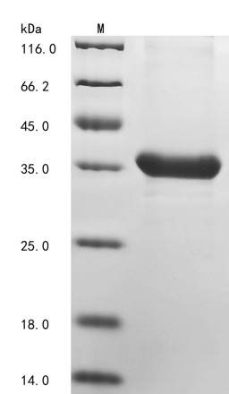 (Tris-Glycine gel) Discontinuous SDS-PAGE (reduced) with 5% enrichment gel and 15% separation gel.