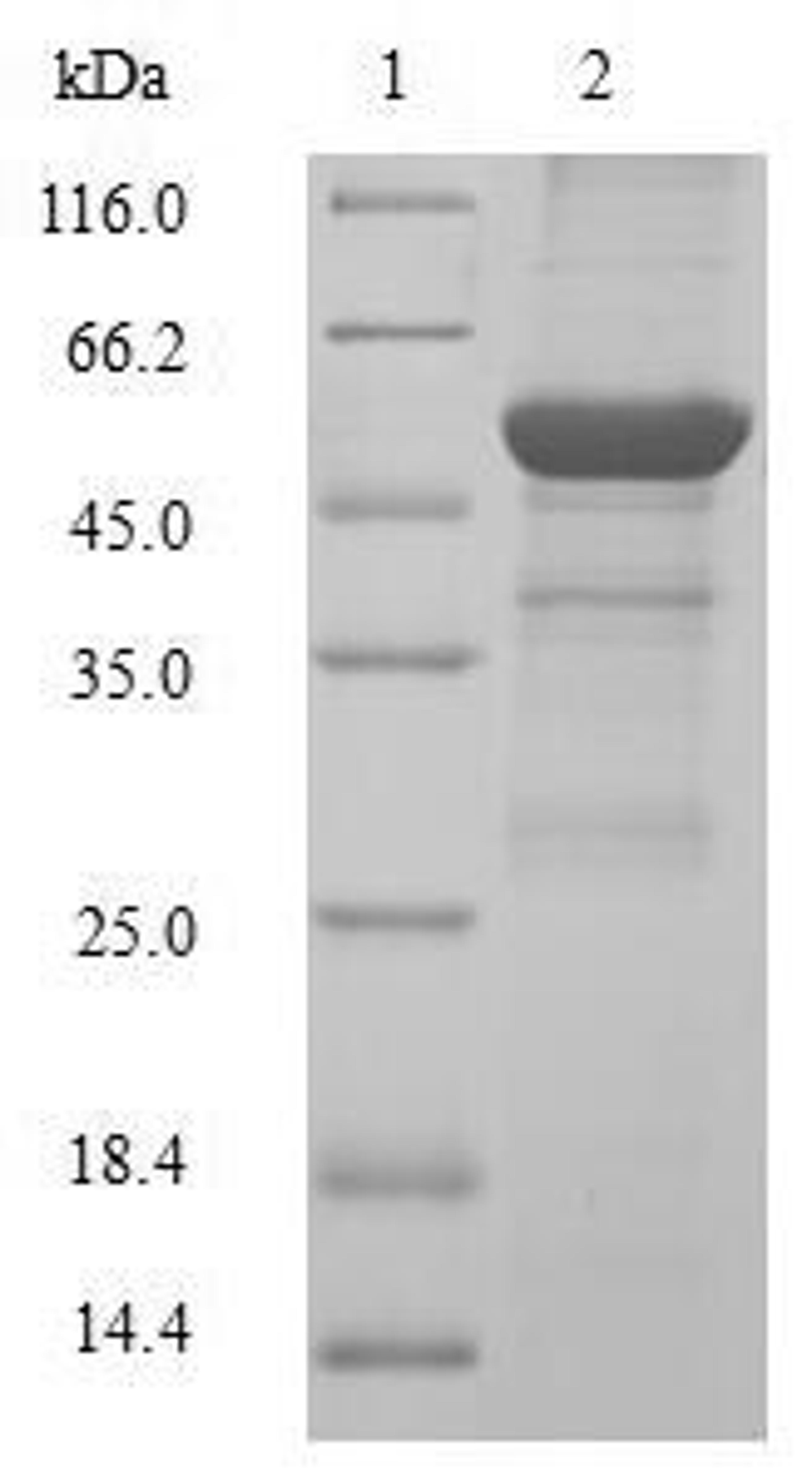 (Tris-Glycine gel) Discontinuous SDS-PAGE (reduced) with 5% enrichment gel and 15% separation gel.