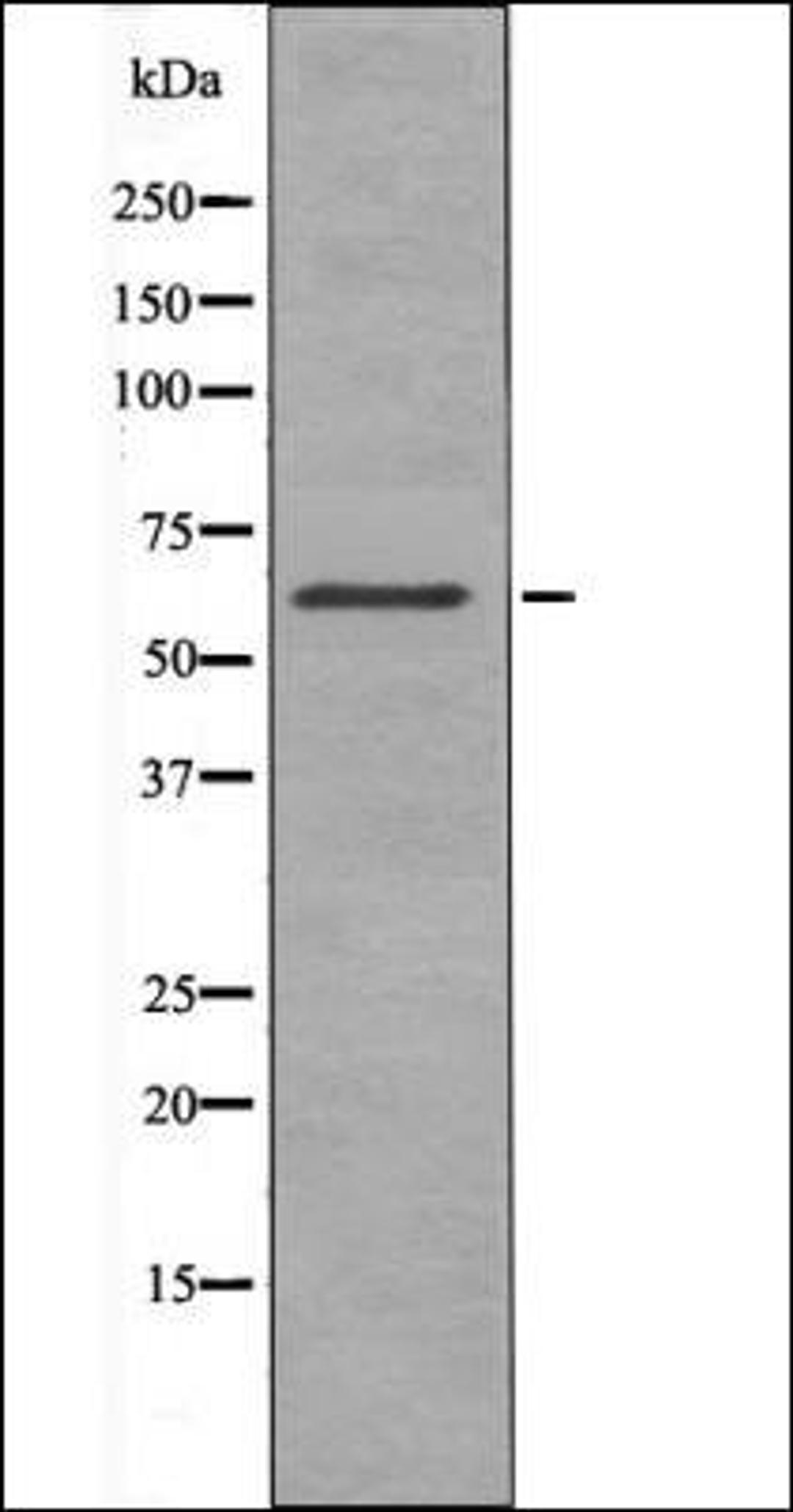 Western blot analysis of K562 whole cell lysates using Chk2 -Phospho-Thr432- antibody