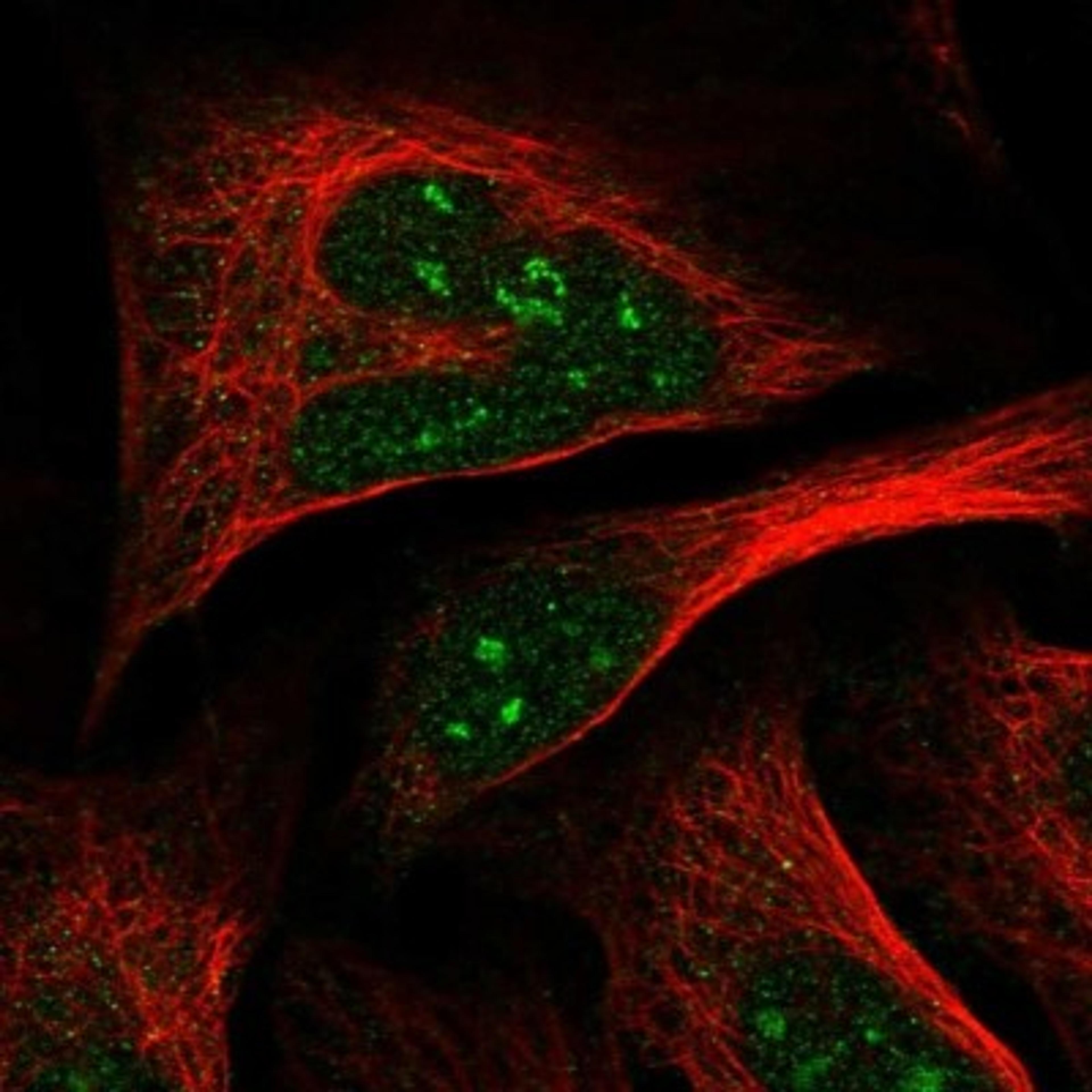 Immunocytochemistry/Immunofluorescence: SLC7A10 Antibody [NBP1-88814] - Staining of human cell line U-2 OS shows positivity in nucleoli.