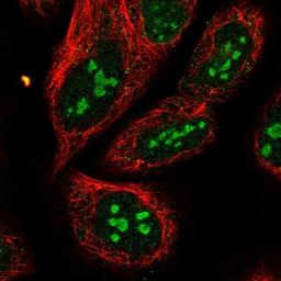 Immunocytochemistry/Immunofluorescence: RCN3 Antibody [NBP2-13213] - Staining of human cell line U-2 OS shows positivity in nucleoli.