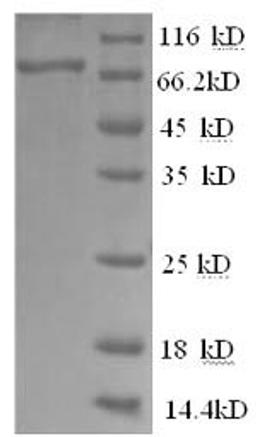 (Tris-Glycine gel) Discontinuous SDS-PAGE (reduced) with 5% enrichment gel and 15% separation gel.