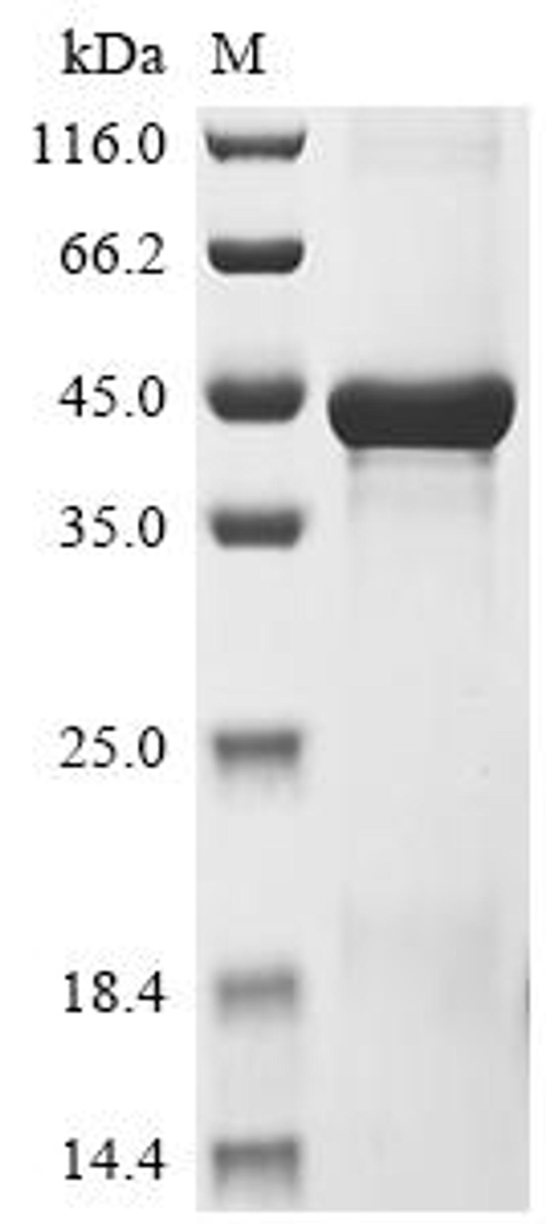 (Tris-Glycine gel) Discontinuous SDS-PAGE (reduced) with 5% enrichment gel and 15% separation gel.