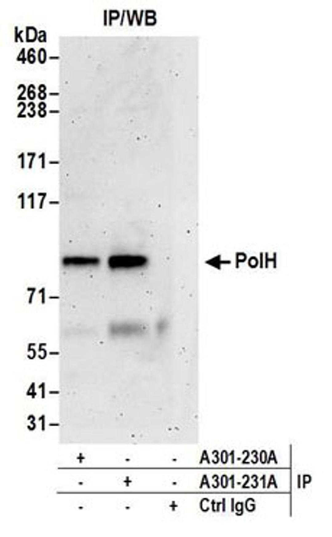 Detection of human PolH by western blot of immunoprecipitates.