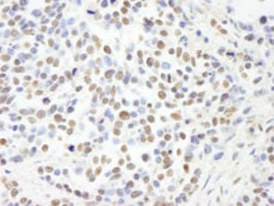 Detection of human RBBP4/RbAp48 by immunohistochemistry.