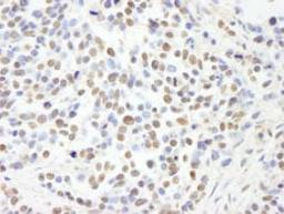 Detection of human RBBP4/RbAp48 by immunohistochemistry.